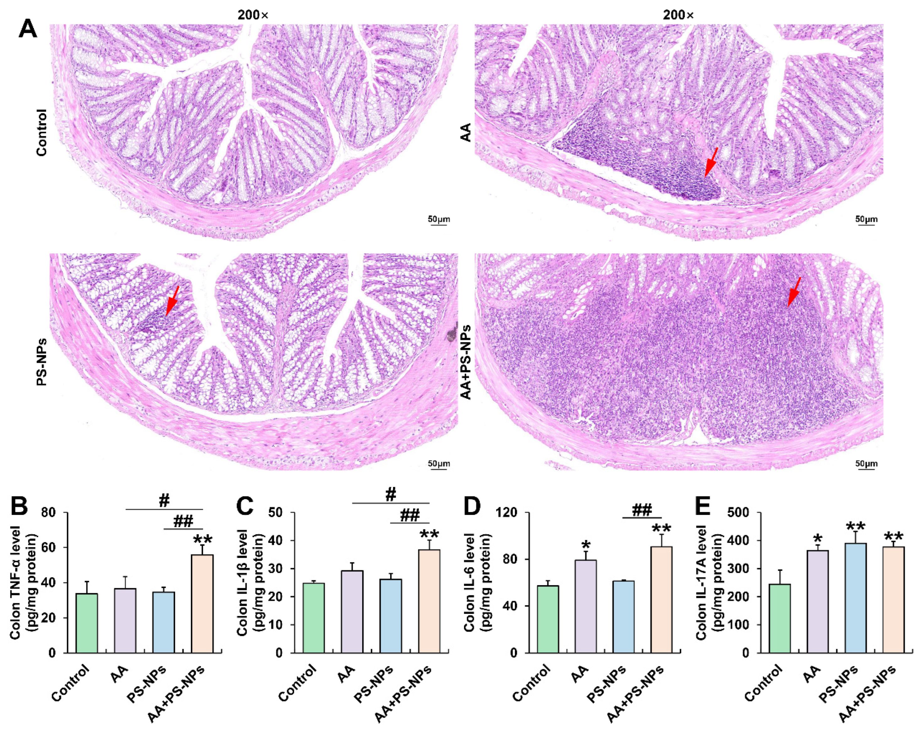 Synergistic Toxicity of Combined Exposure to Acrylamide and