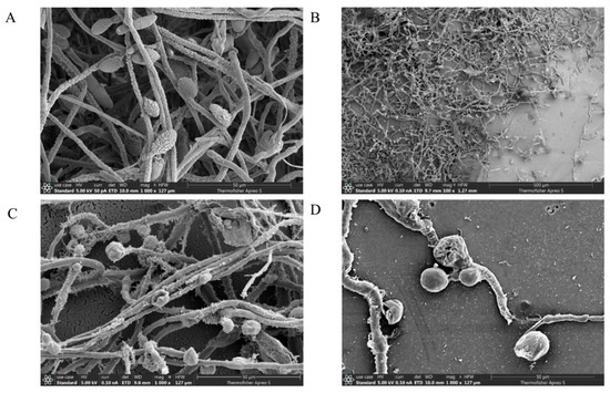 Biocontrol Effect and Antibacterial Mechanism of Bacillus