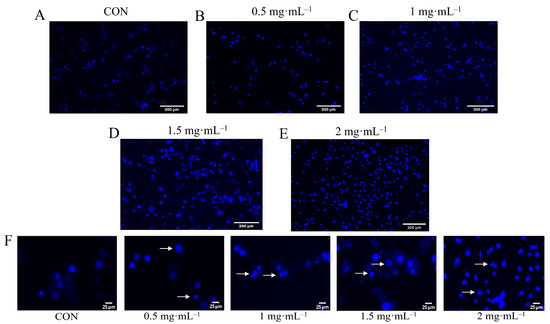 Mechanistic Study on the Inhibitory Effect of Dandelion