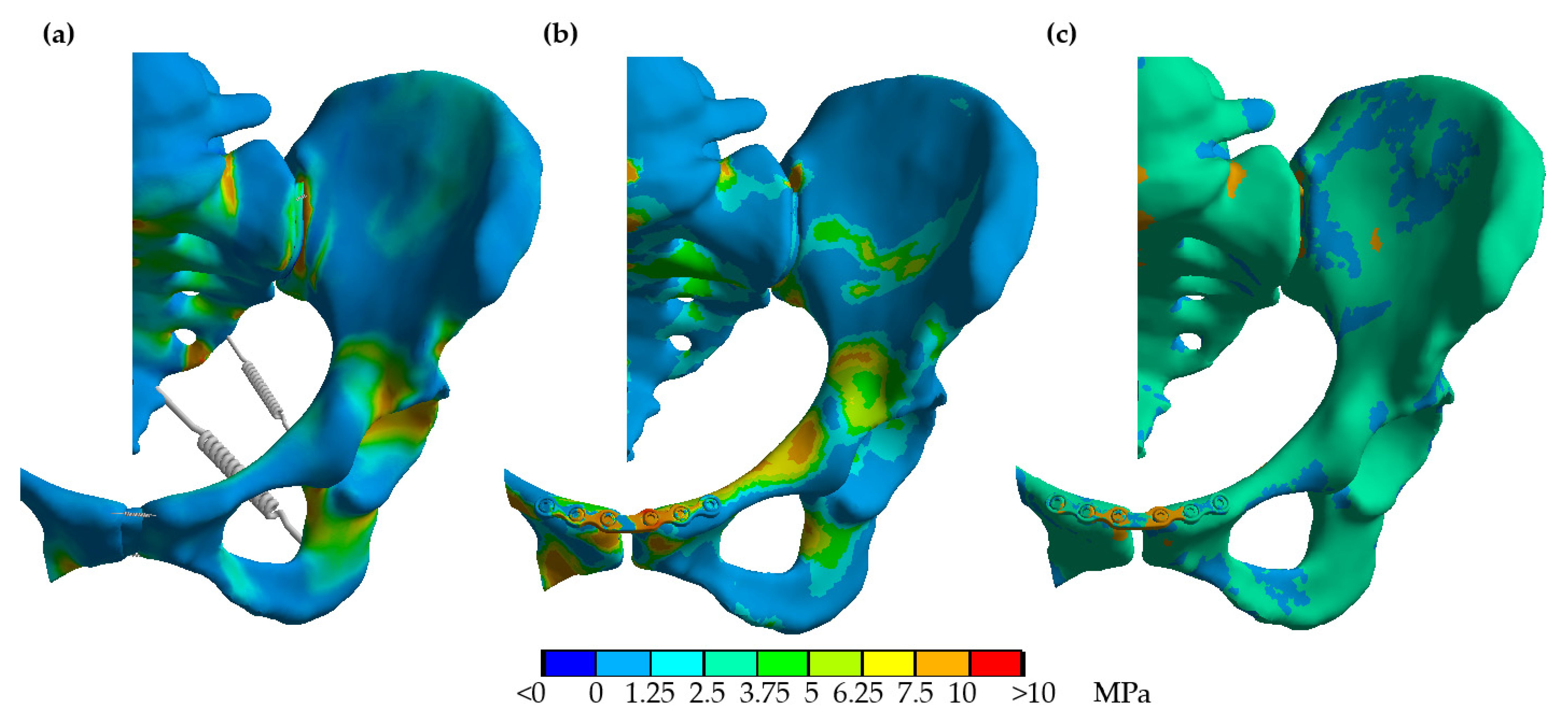 Biomechanics 01 00027 g004 Biomechanics 01 00027 g004