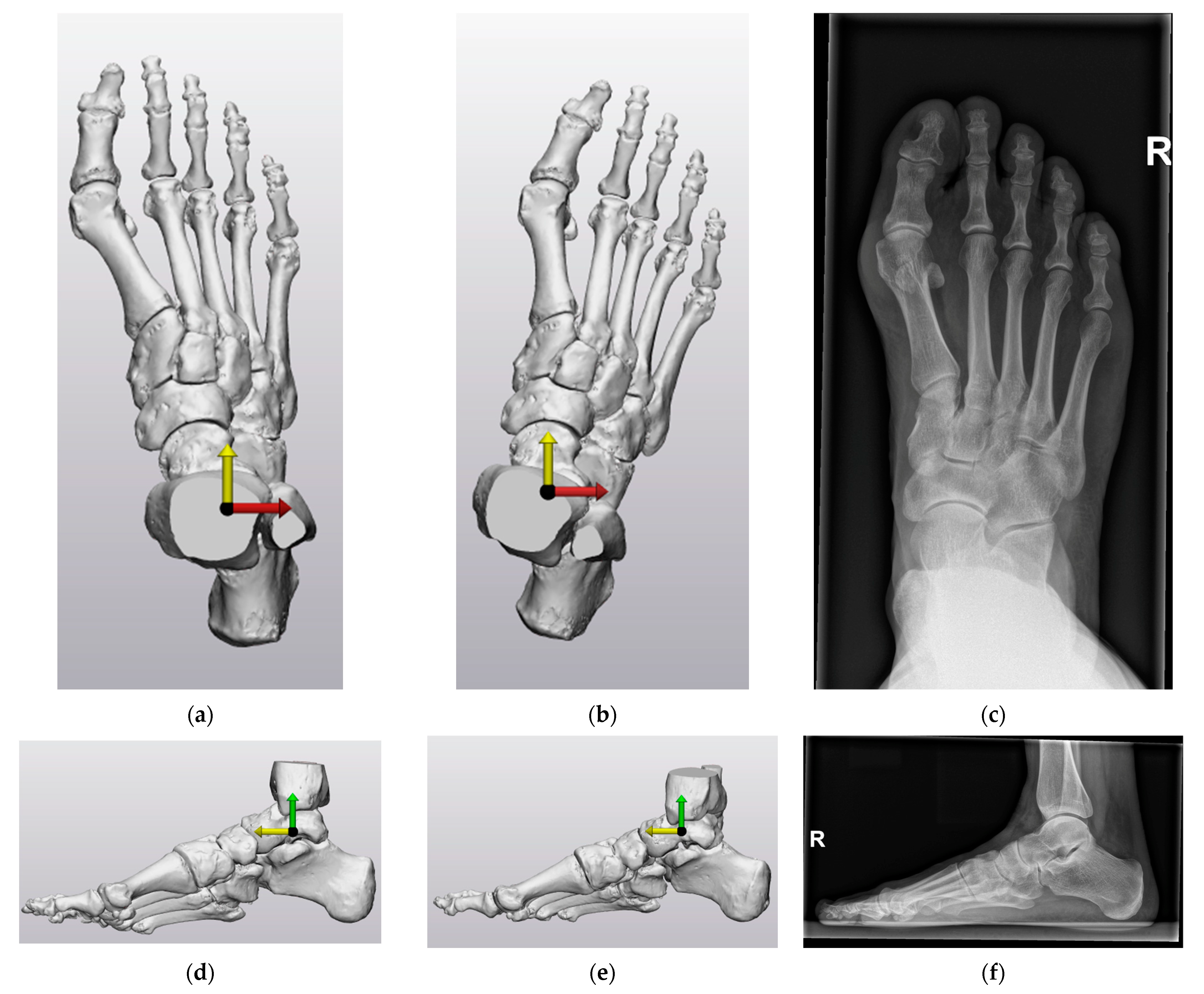 Biomechanics 03 00042 g007