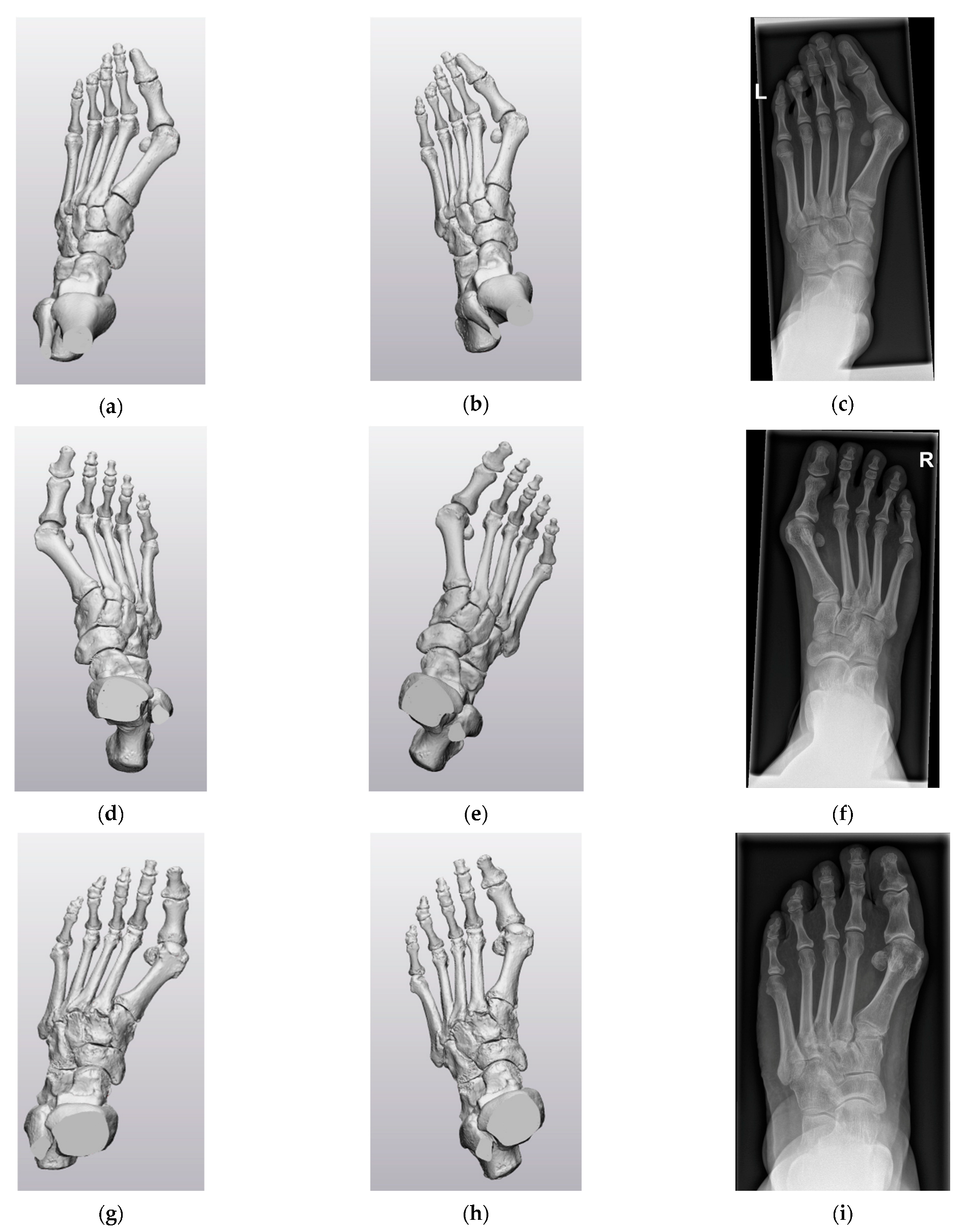 Biomechanics 03 00042 g0a1