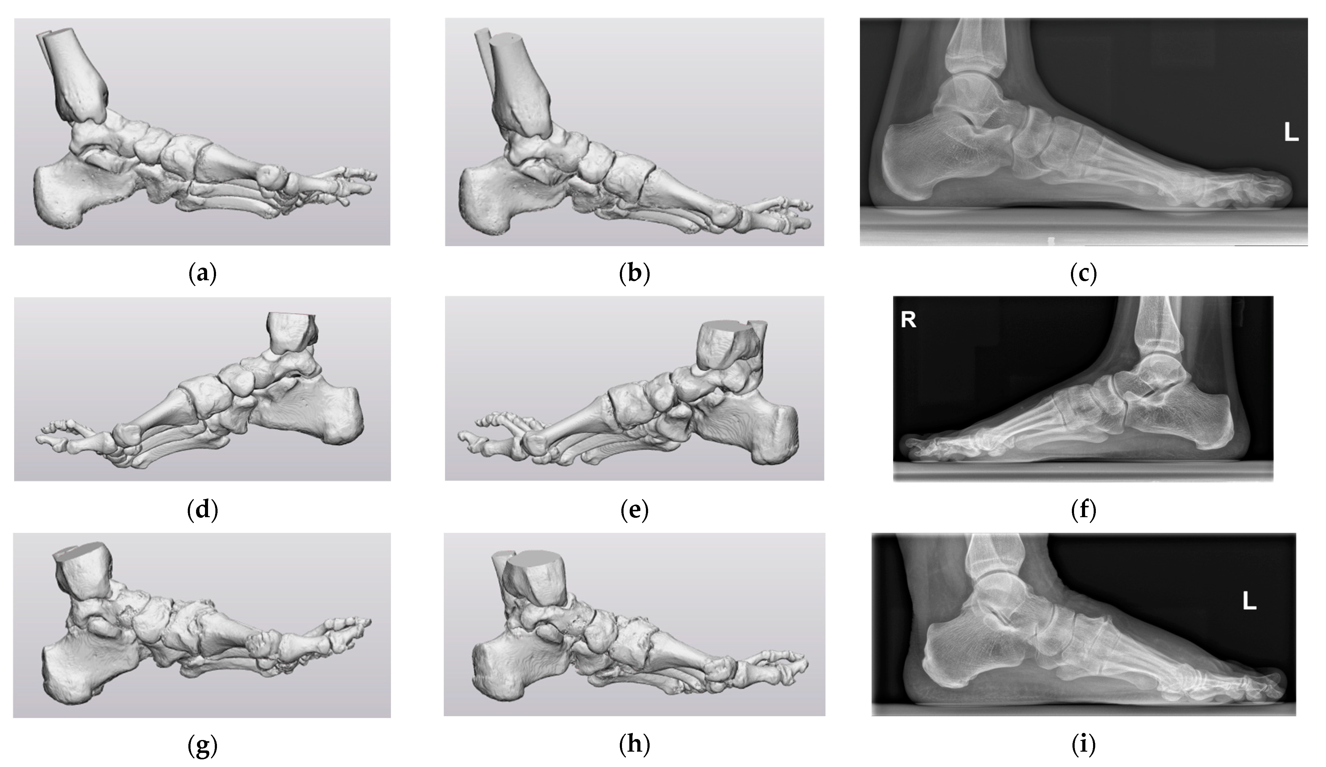 Biomechanics 03 00042 g0a2