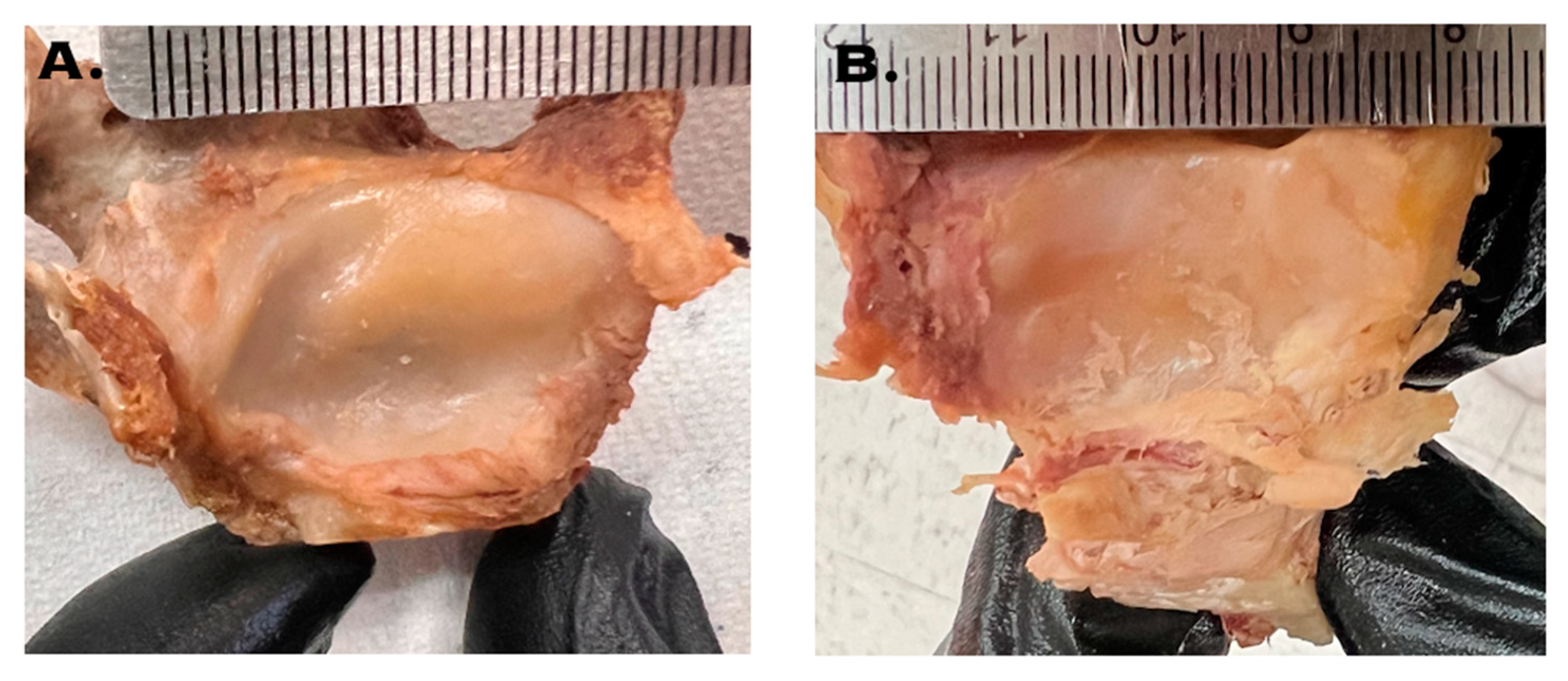 Biomechanics 04 00026 g005