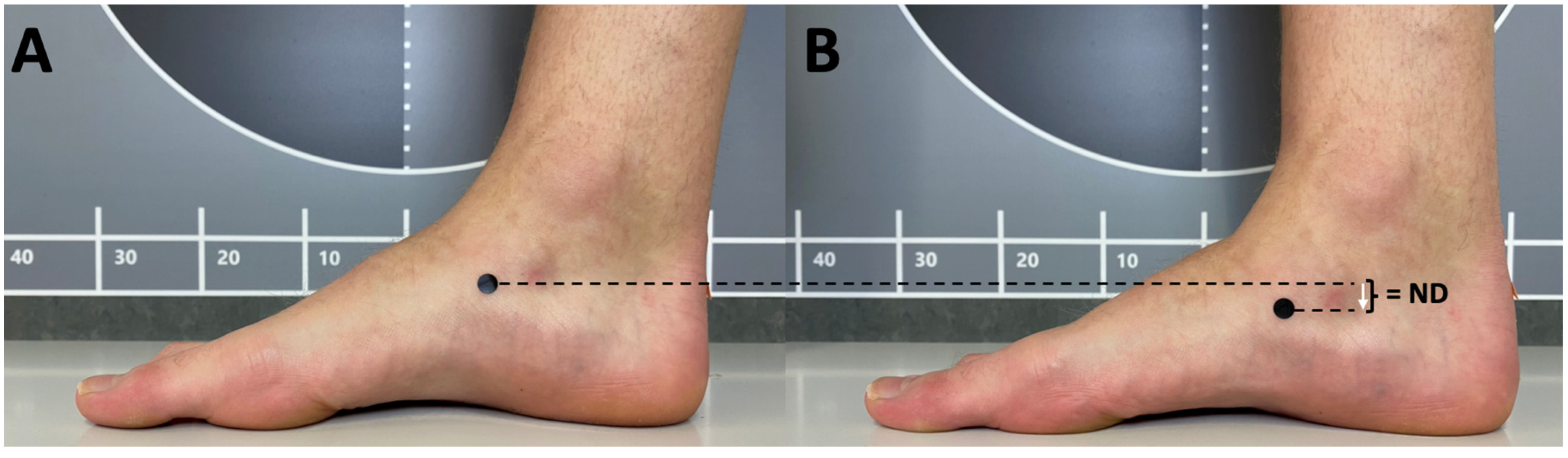 Pronation fatigue sales