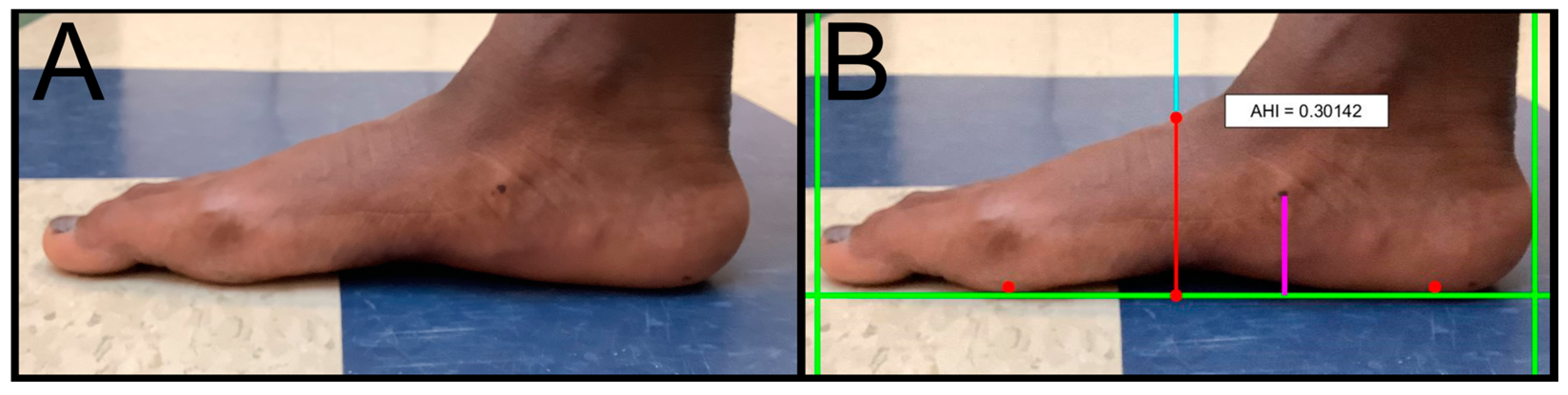 Biomechanics 04 00055 g001
