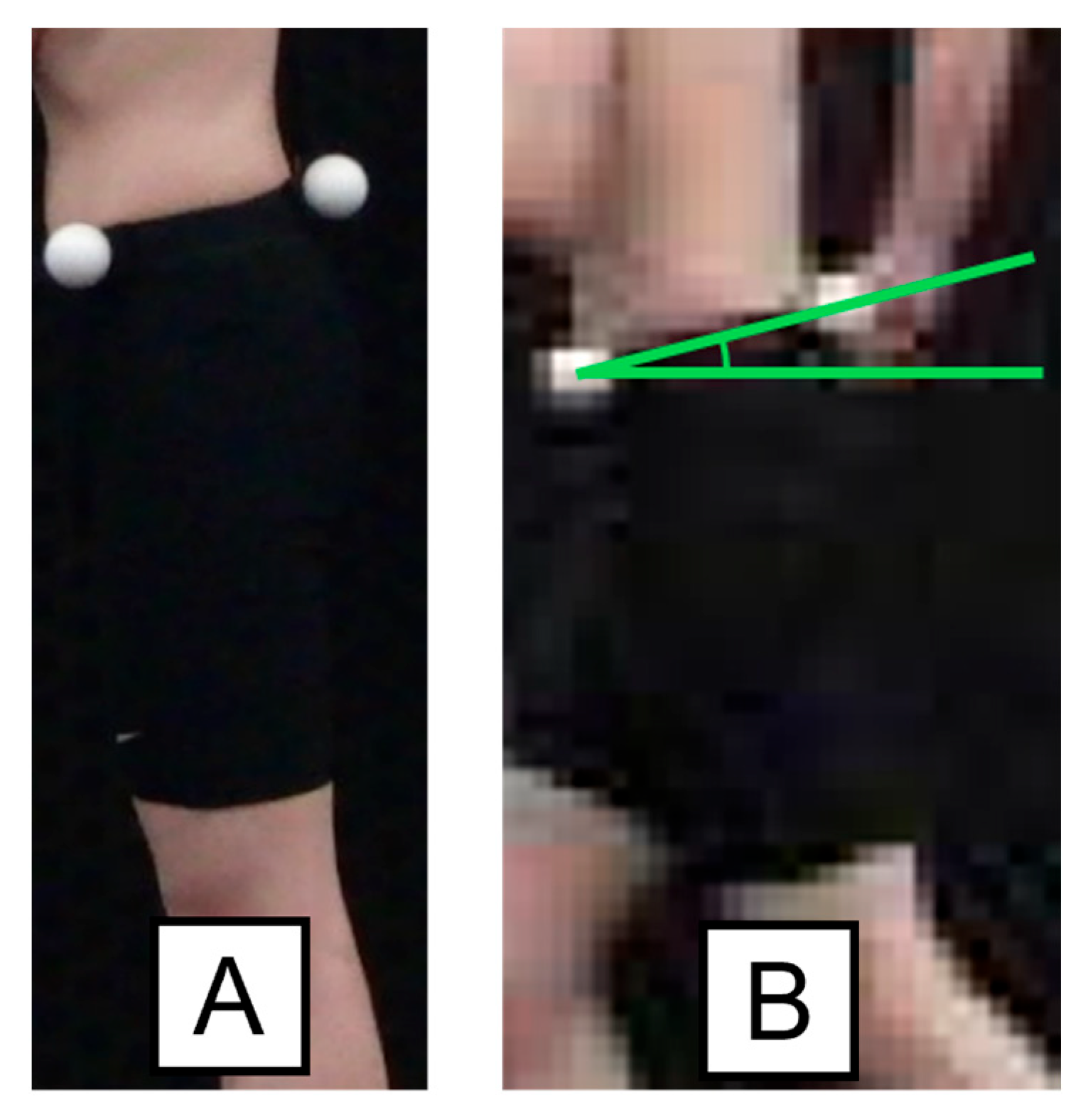 Biomechanics 04 00056 g001 Biomechanics 04 00056 g001