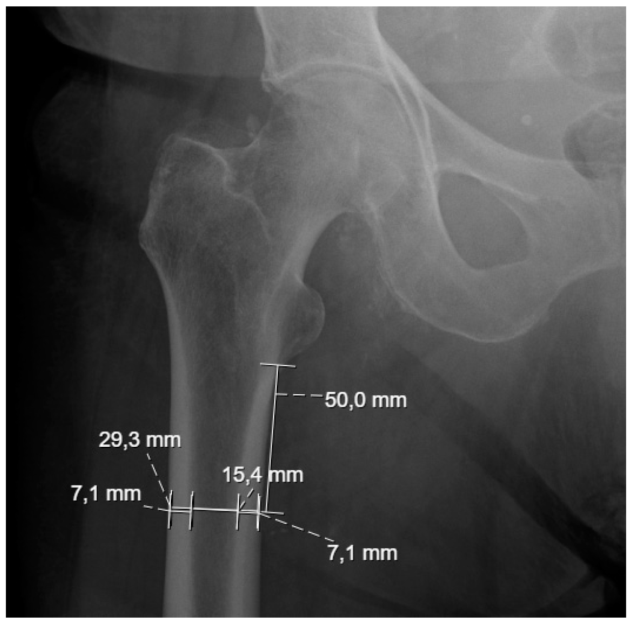 Biomechanics 05 00012 g001
