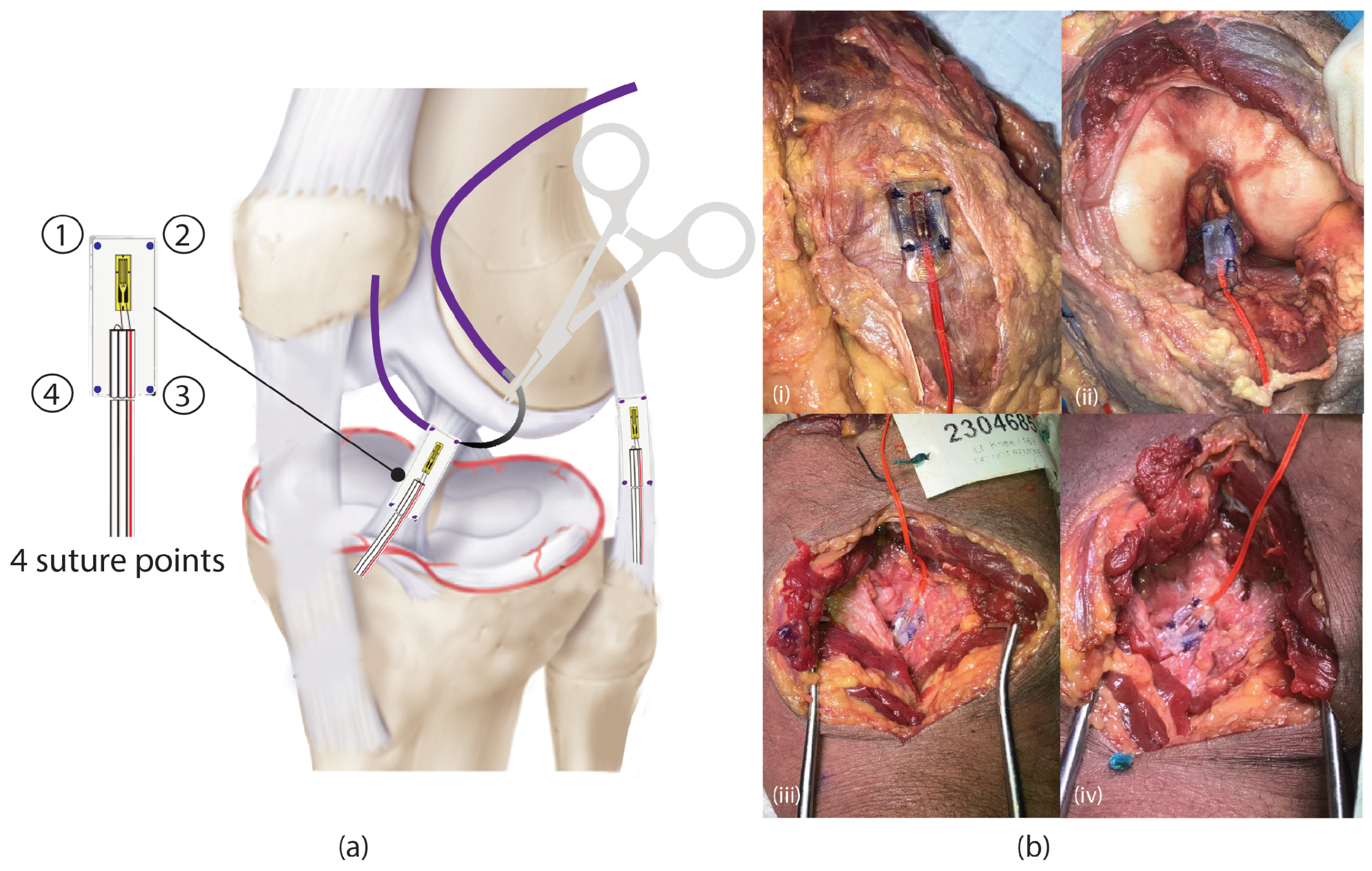 Biomechanics 05 00038 g001