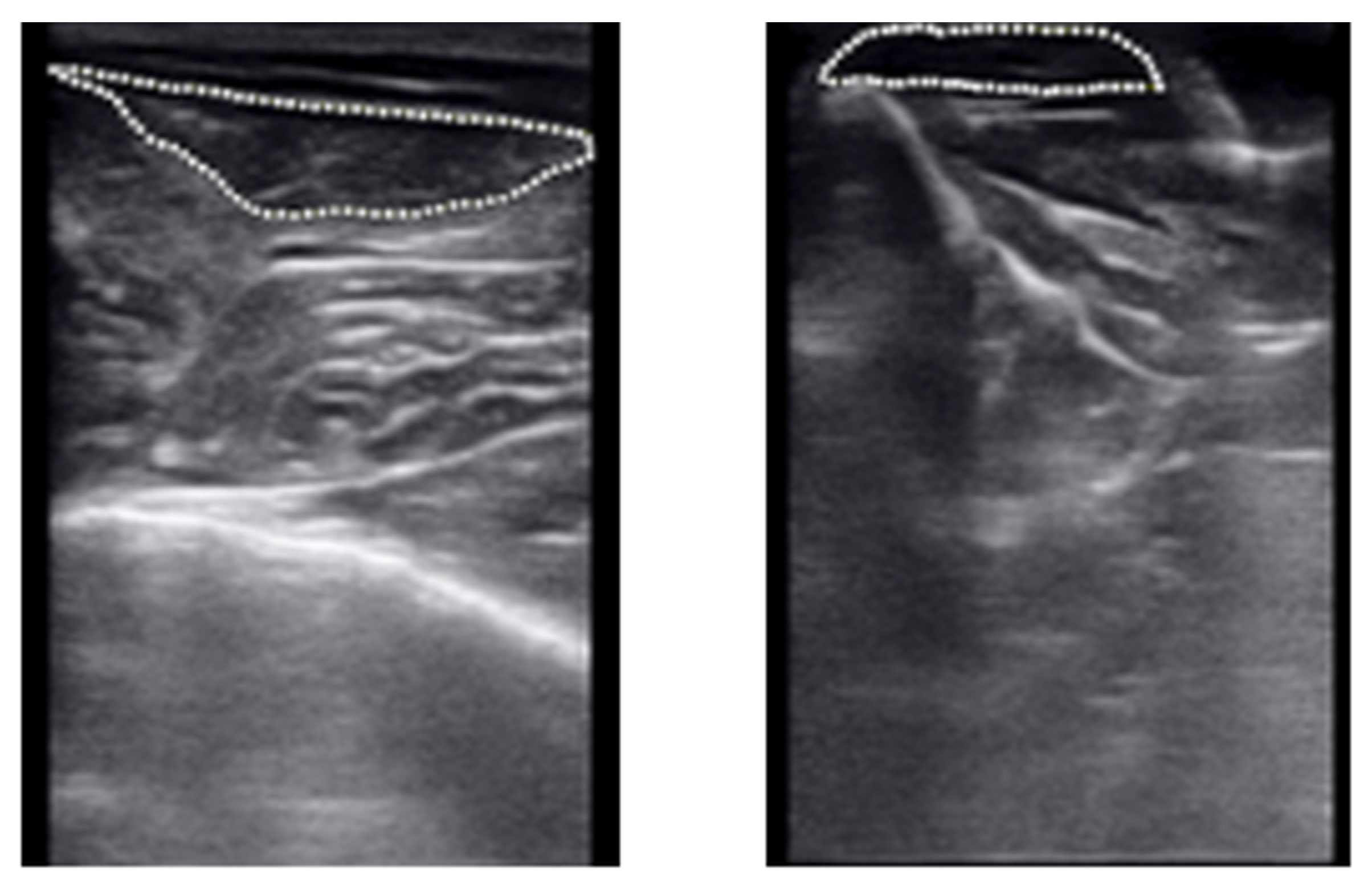 Biomechanics 05 00047 g004