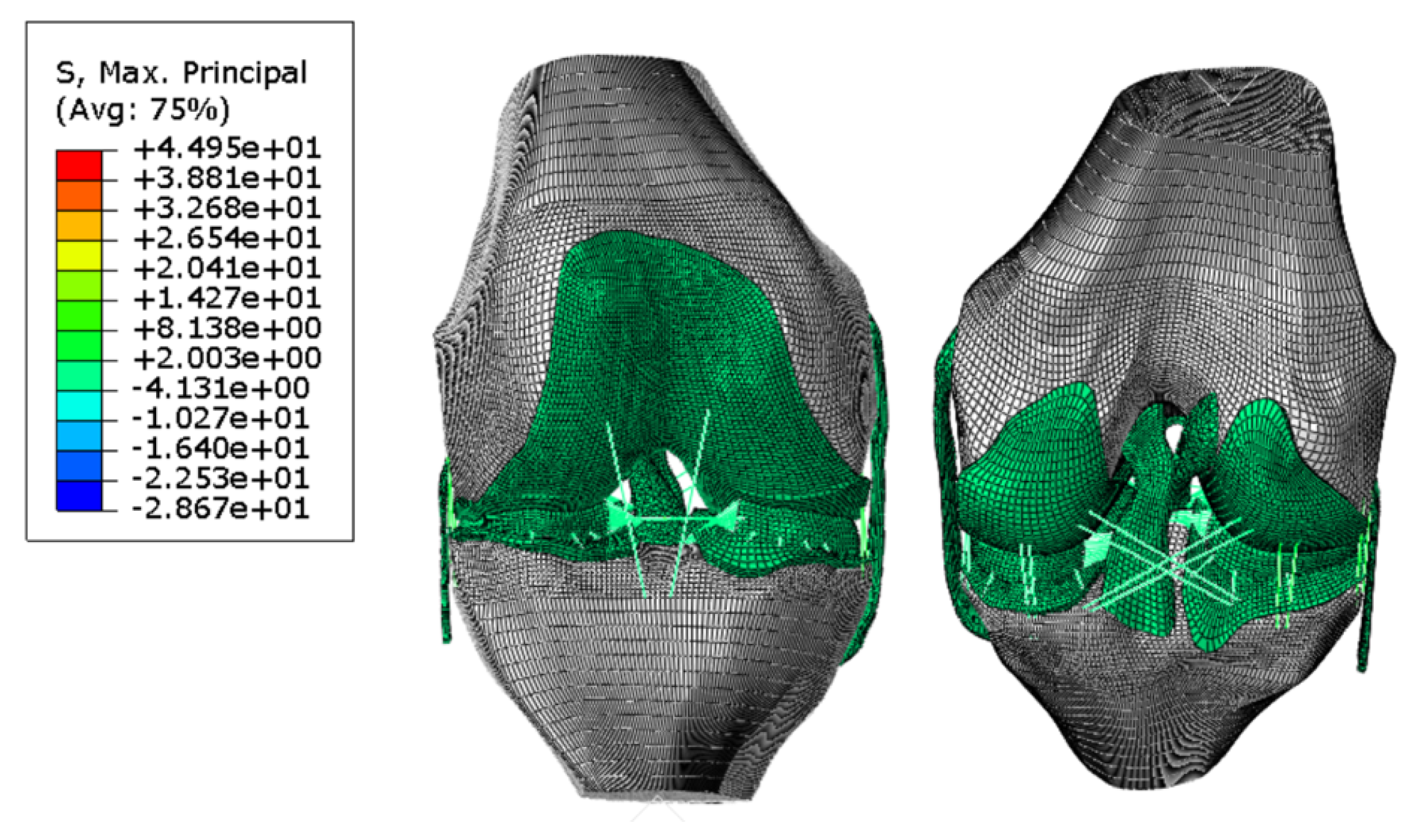 Biomechanics 05 00057 g008