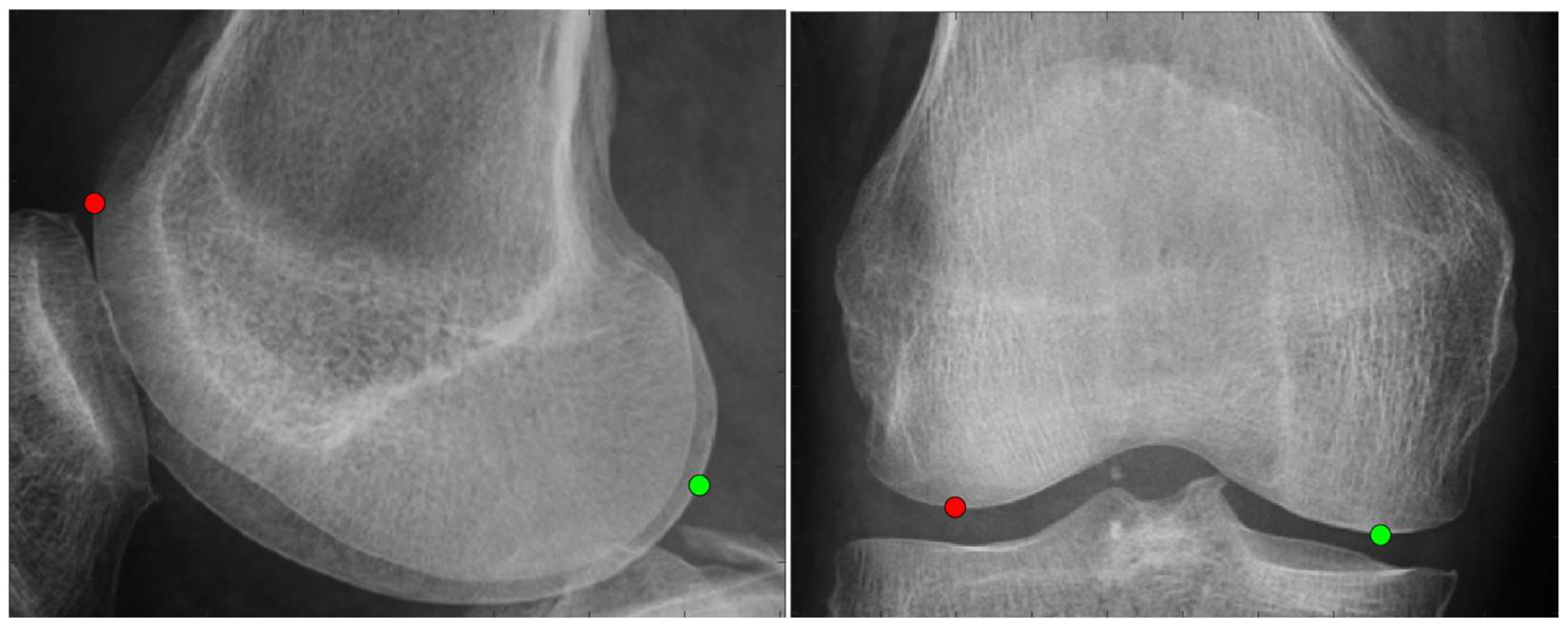 Biomechanics 05 00063 g004 Biomechanics 05 00063 g004
