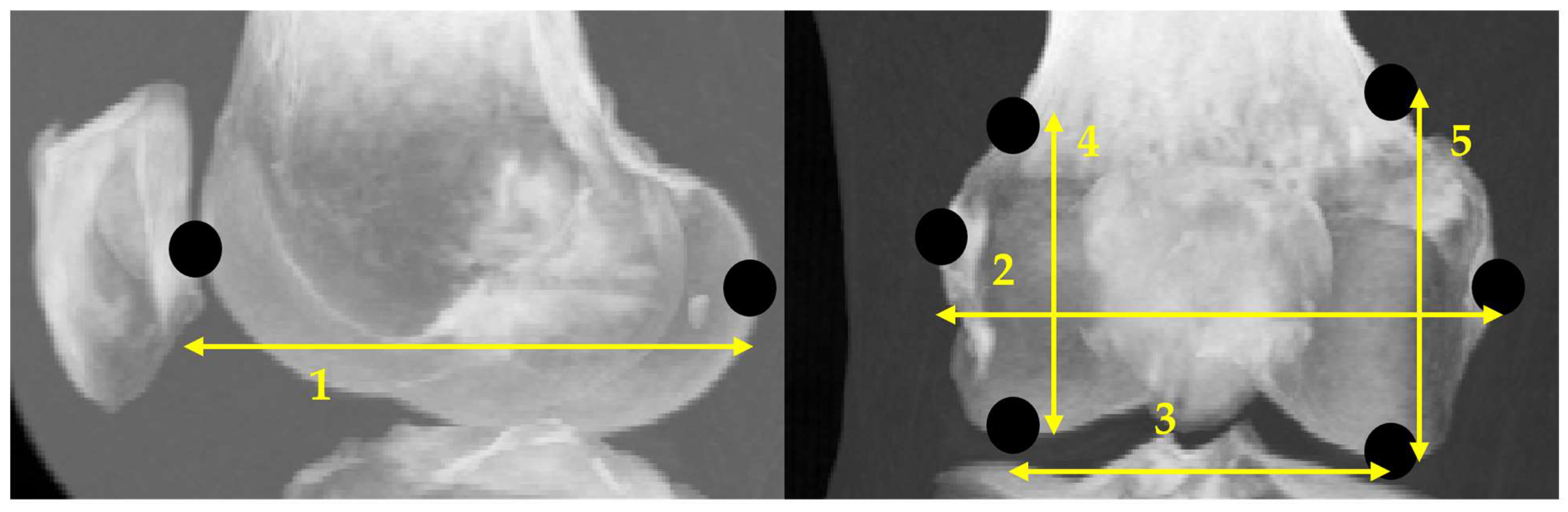 Biomechanics 05 00063 g005 Biomechanics 05 00063 g005