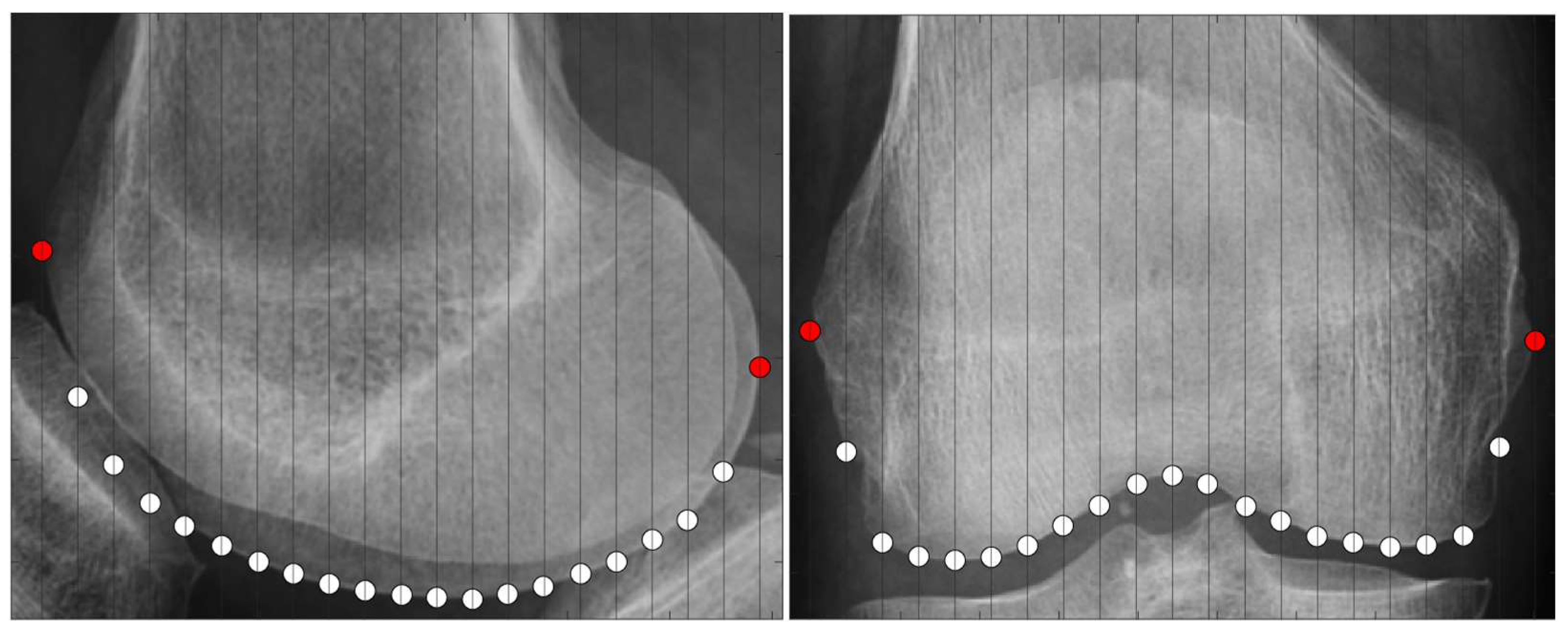 Biomechanics 05 00063 g006 Biomechanics 05 00063 g006