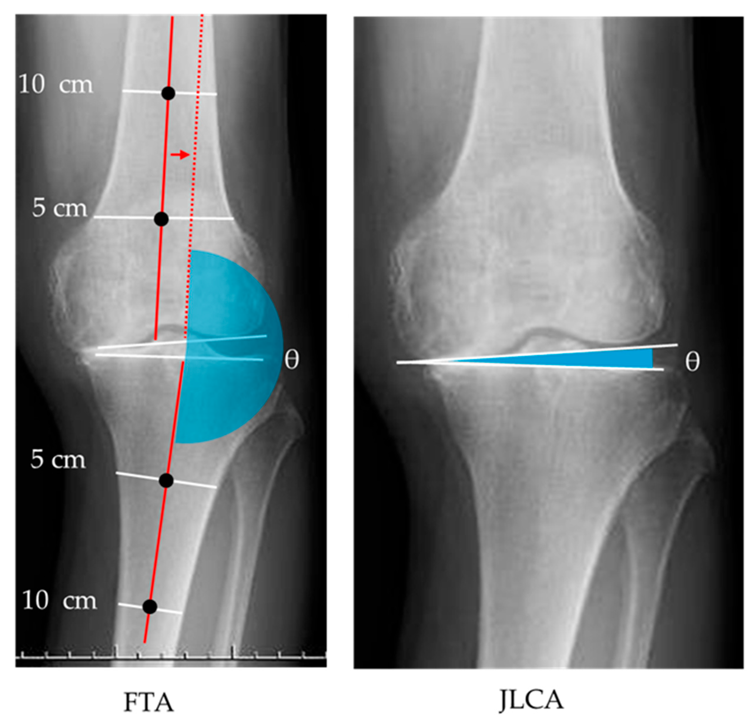 Biomechanics 05 00098 g003
