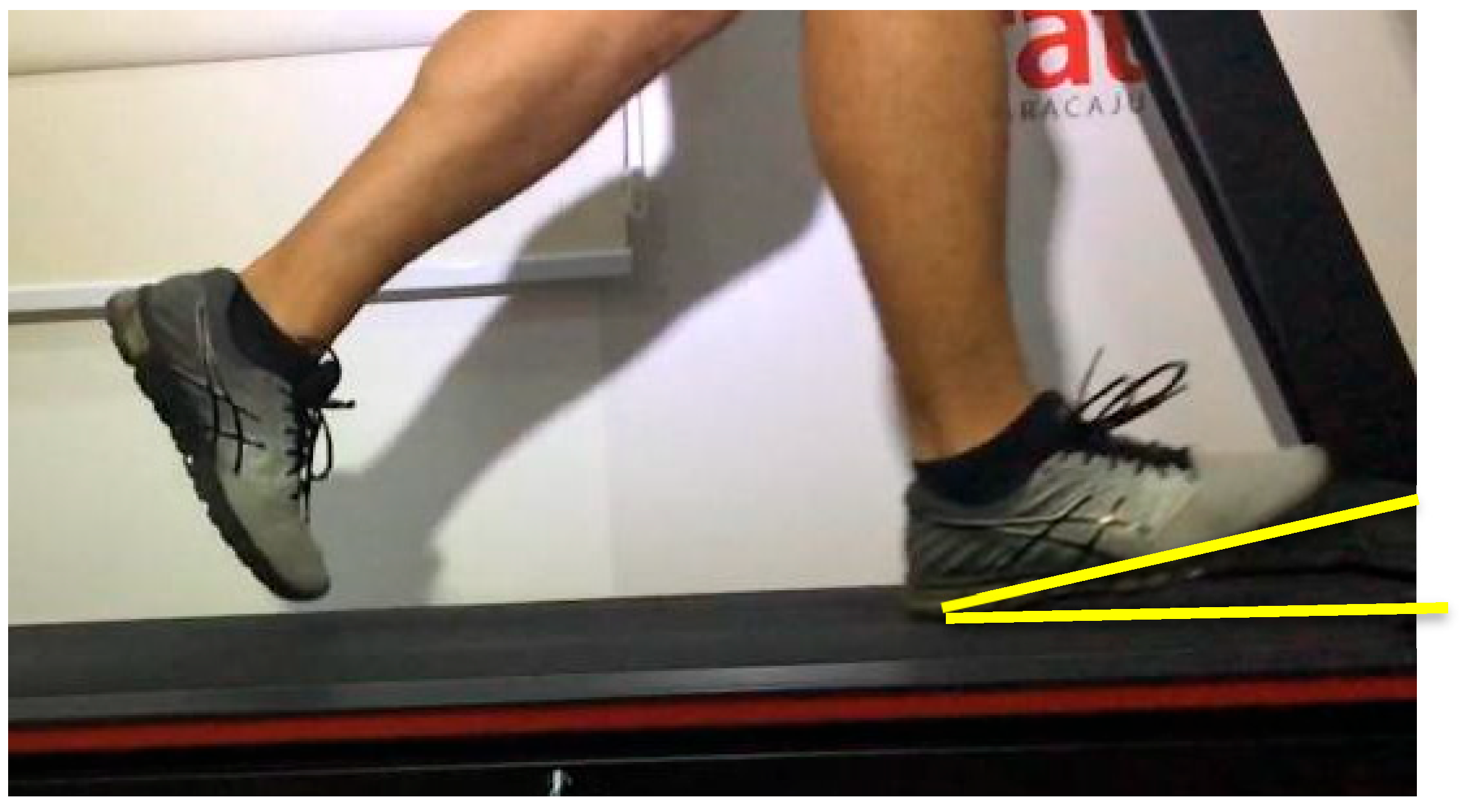 Biomechanics 05 00106 g002 Biomechanics 05 00106 g002