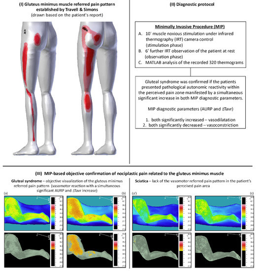 travell and simons referred pain patterns