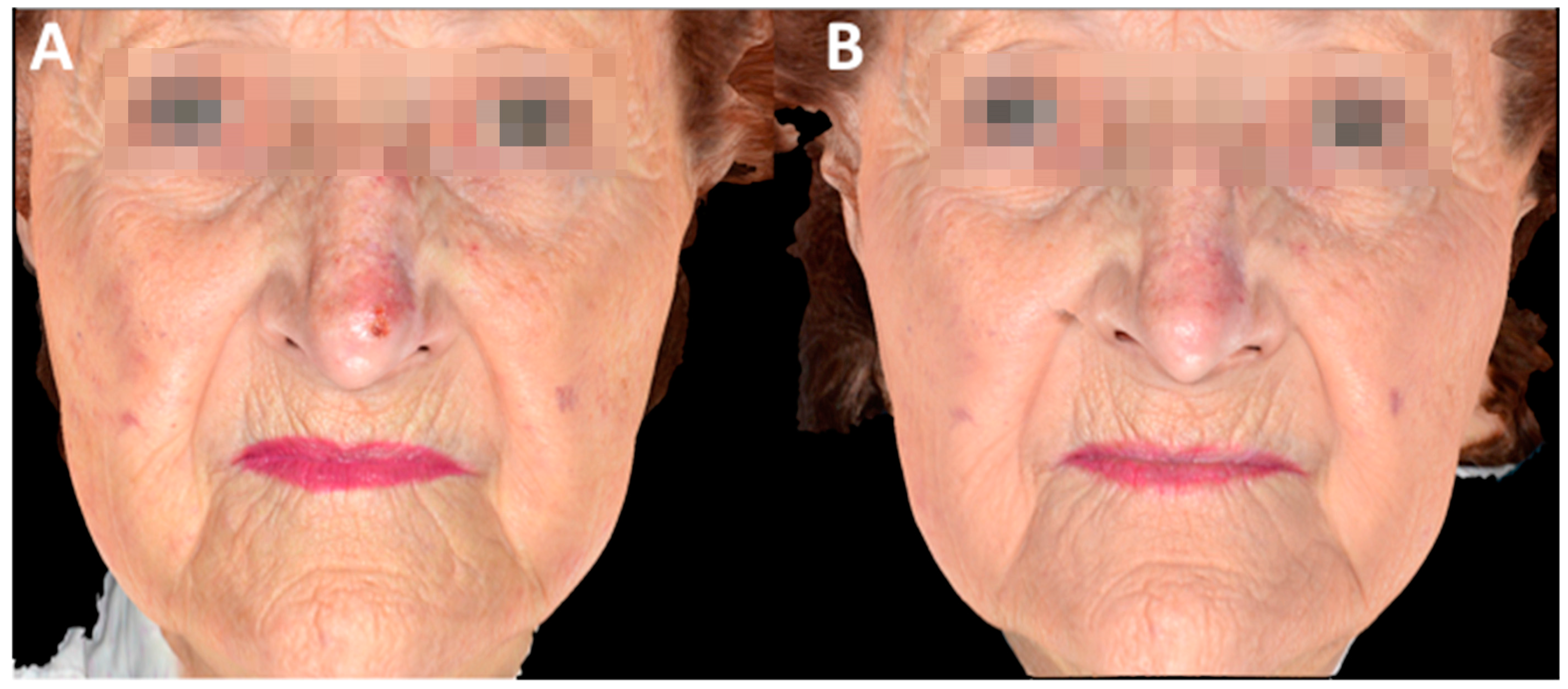 Biomedicines 06 00018 g004 550