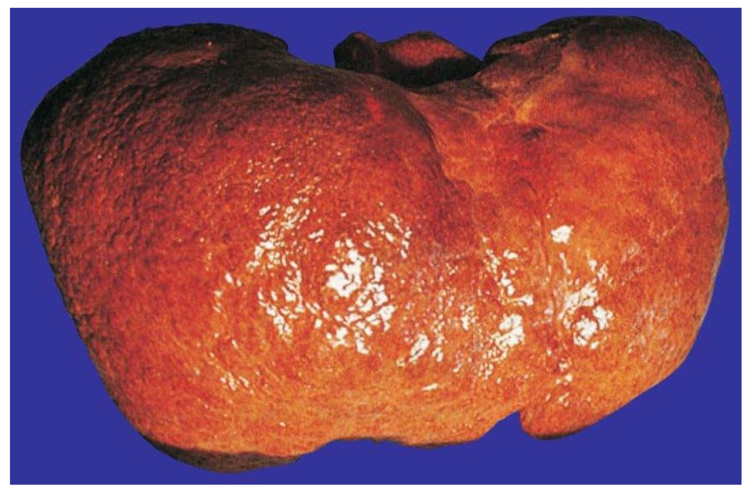 Biomedicines 06 00106 g019