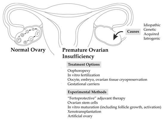 biomedicines-free-full-text-premature-ovarian-insufficiency