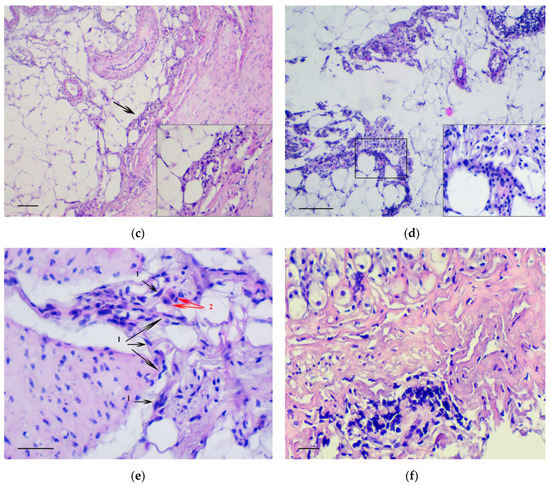 のあーる biomedicines-07-00021-ag-550.