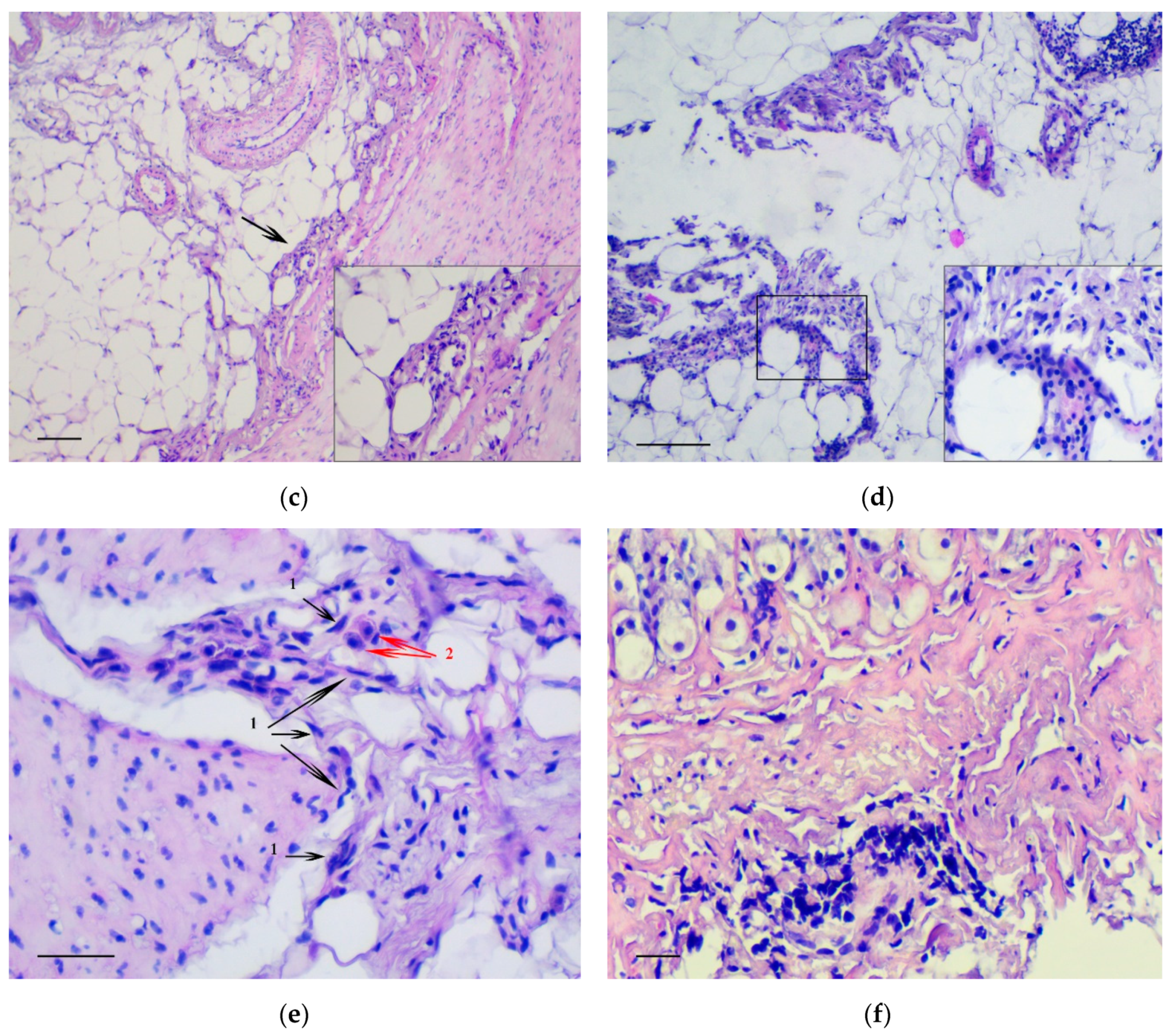 Calcium Carbonate Nanoparticles Can Activate the Epithelial