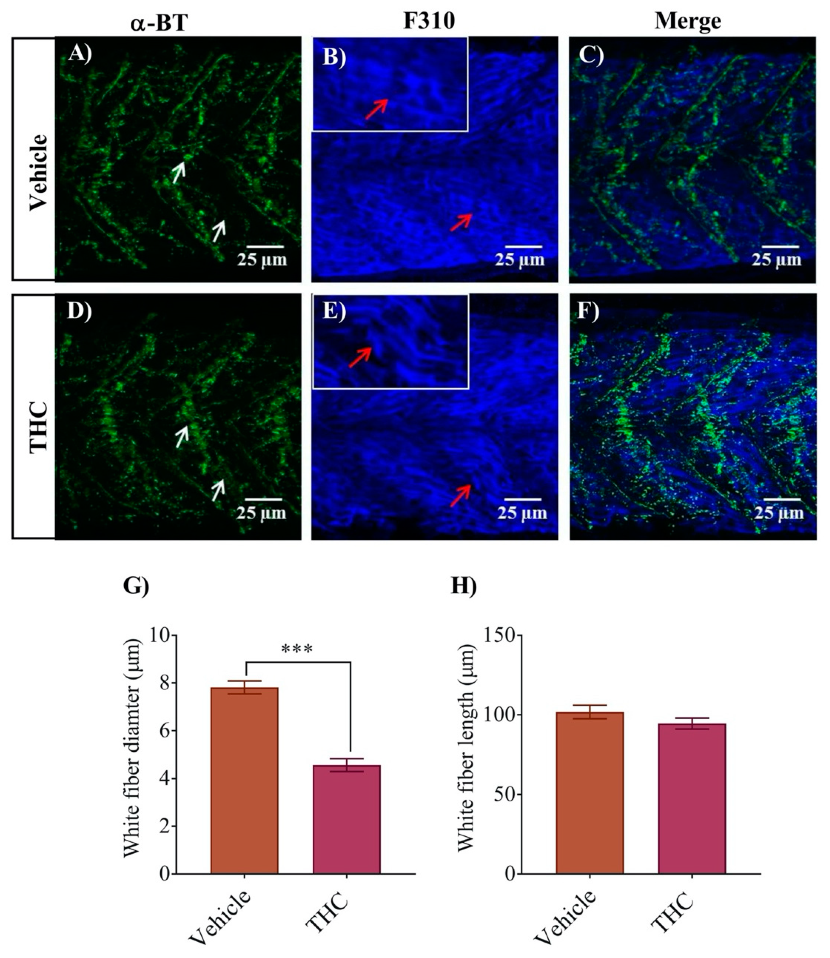 Biomedicines 08 00005 g004