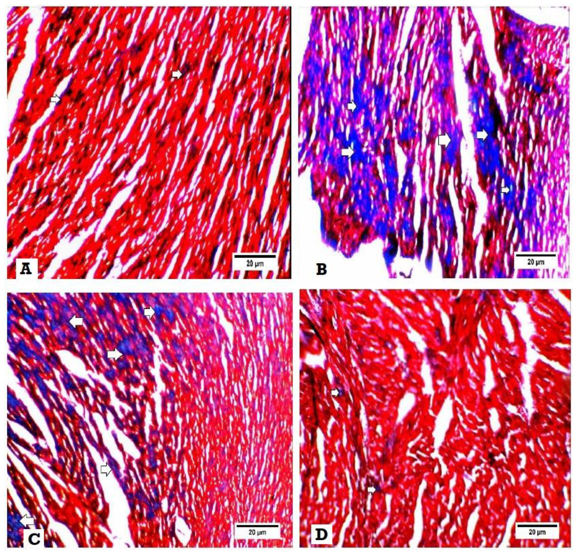 Biomedicines 08 00043 g004 Biomedicines 08 00043 g004