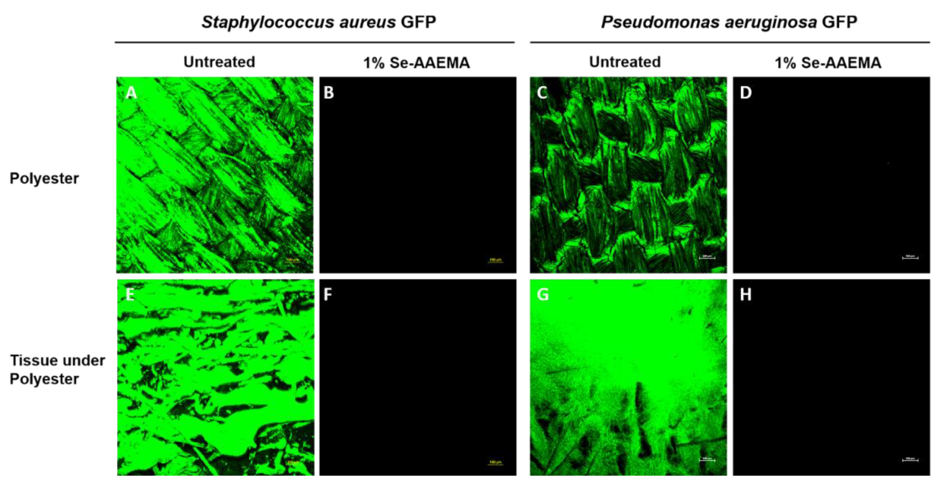 Biomedicines 08 00062 g004
