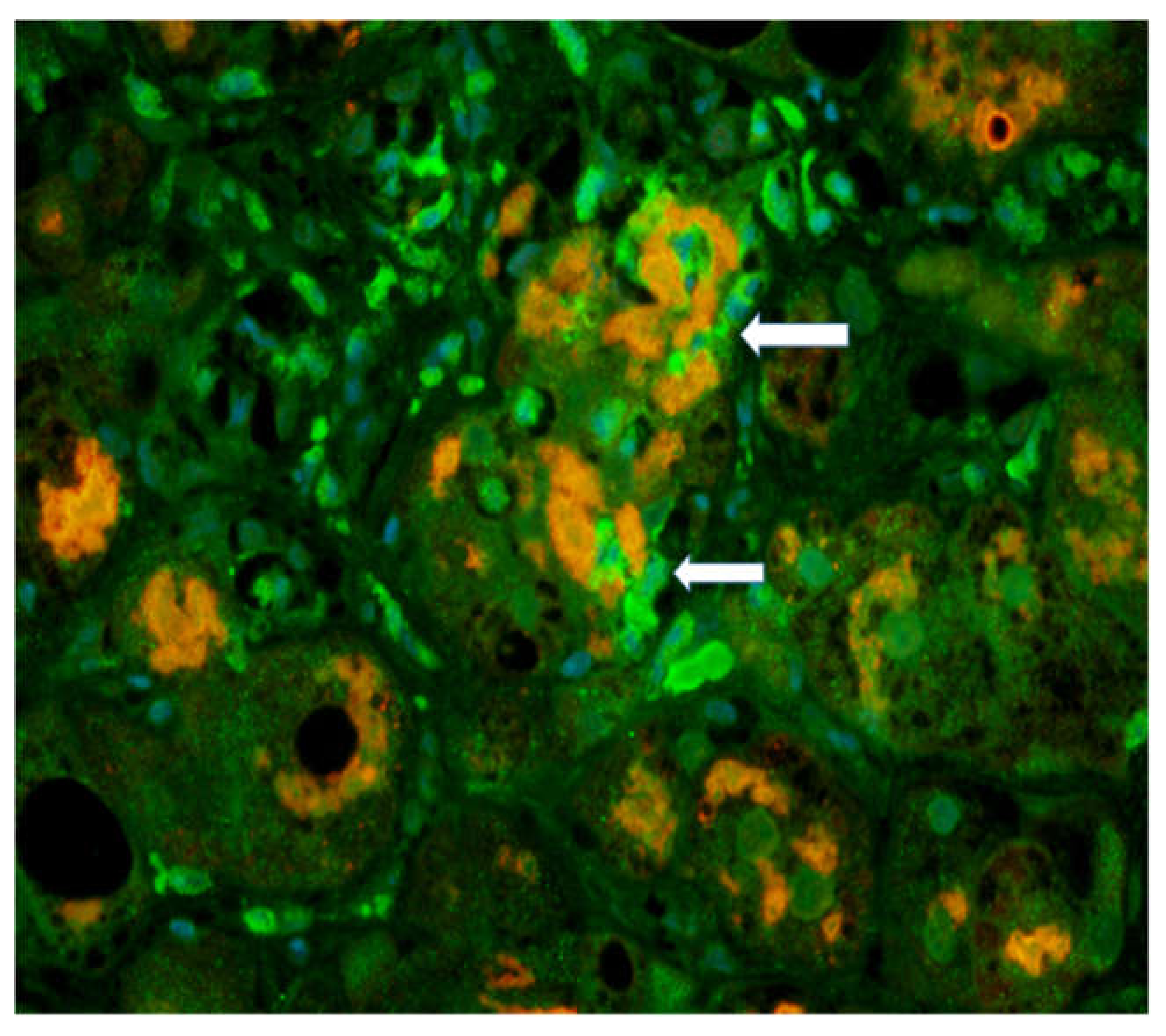 Biomedicines 08 00063 g001 Biomedicines 08 00063 g001
