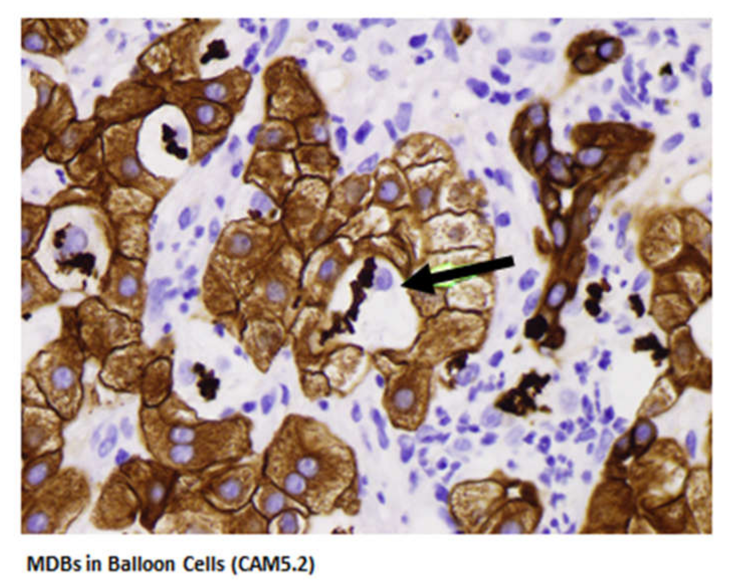 Biomedicines 08 00063 g003 Biomedicines 08 00063 g003