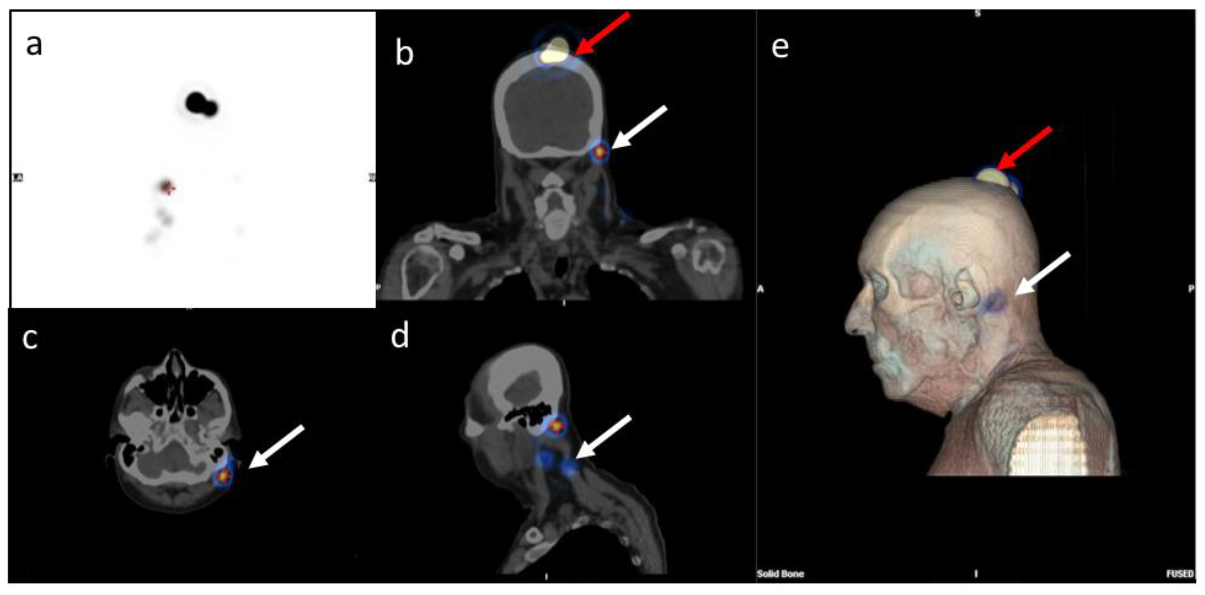 Biomedicines 08 00070 g001 Biomedicines 08 00070 g001