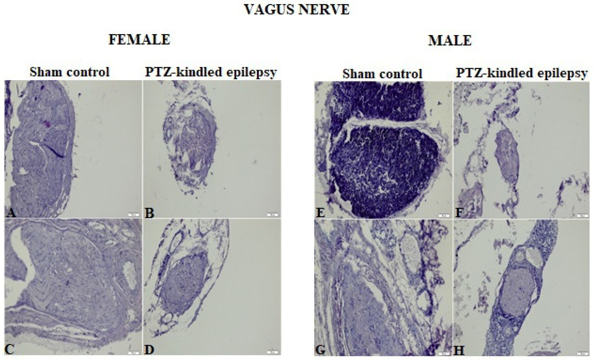 Biomedicines 08 00113 g004 Biomedicines 08 00113 g004