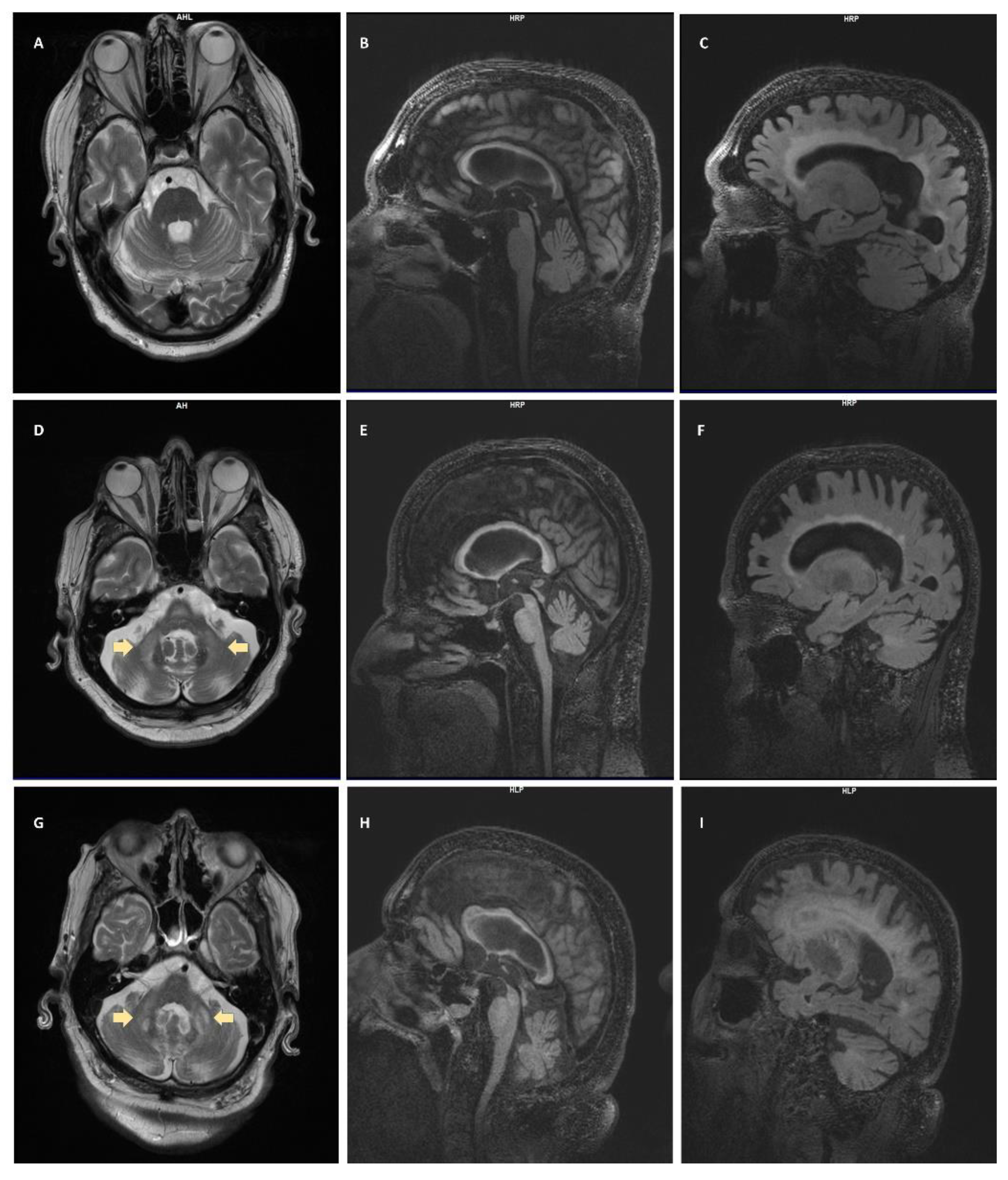 Biomedicines 08 00136 g001