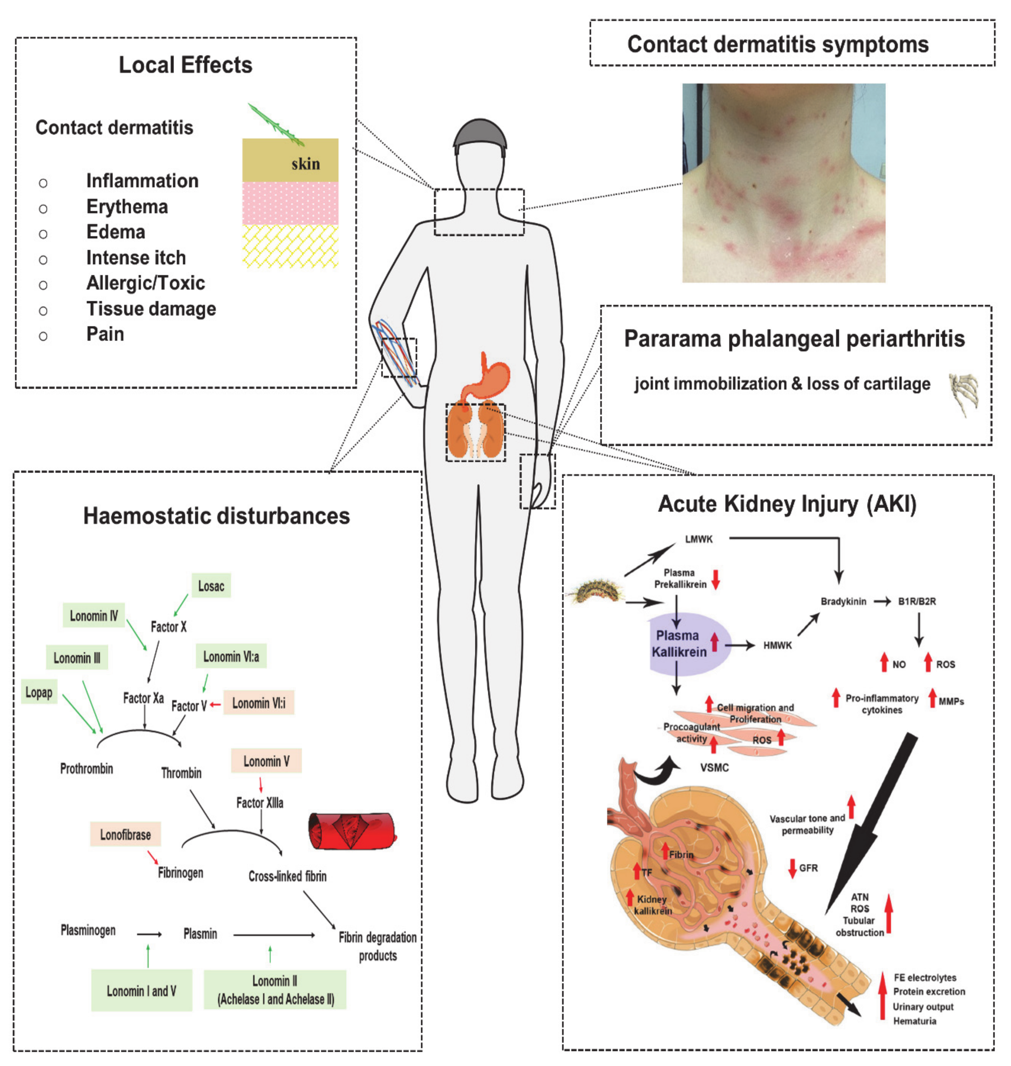 Biomedicines 08 00143 g004 Biomedicines 08 00143 g004