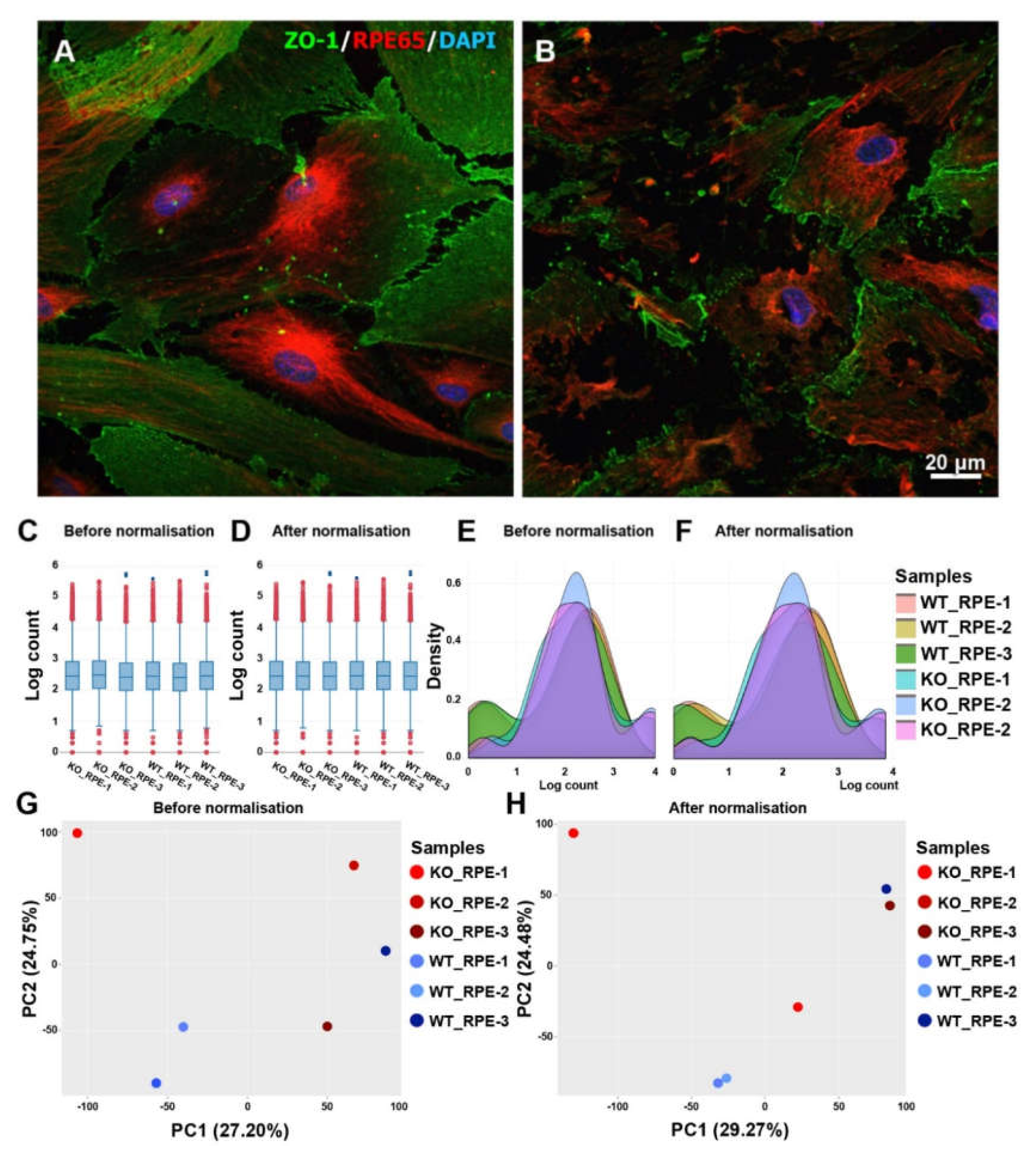 Biomedicines 08 00147 g001 Biomedicines 08 00147 g001