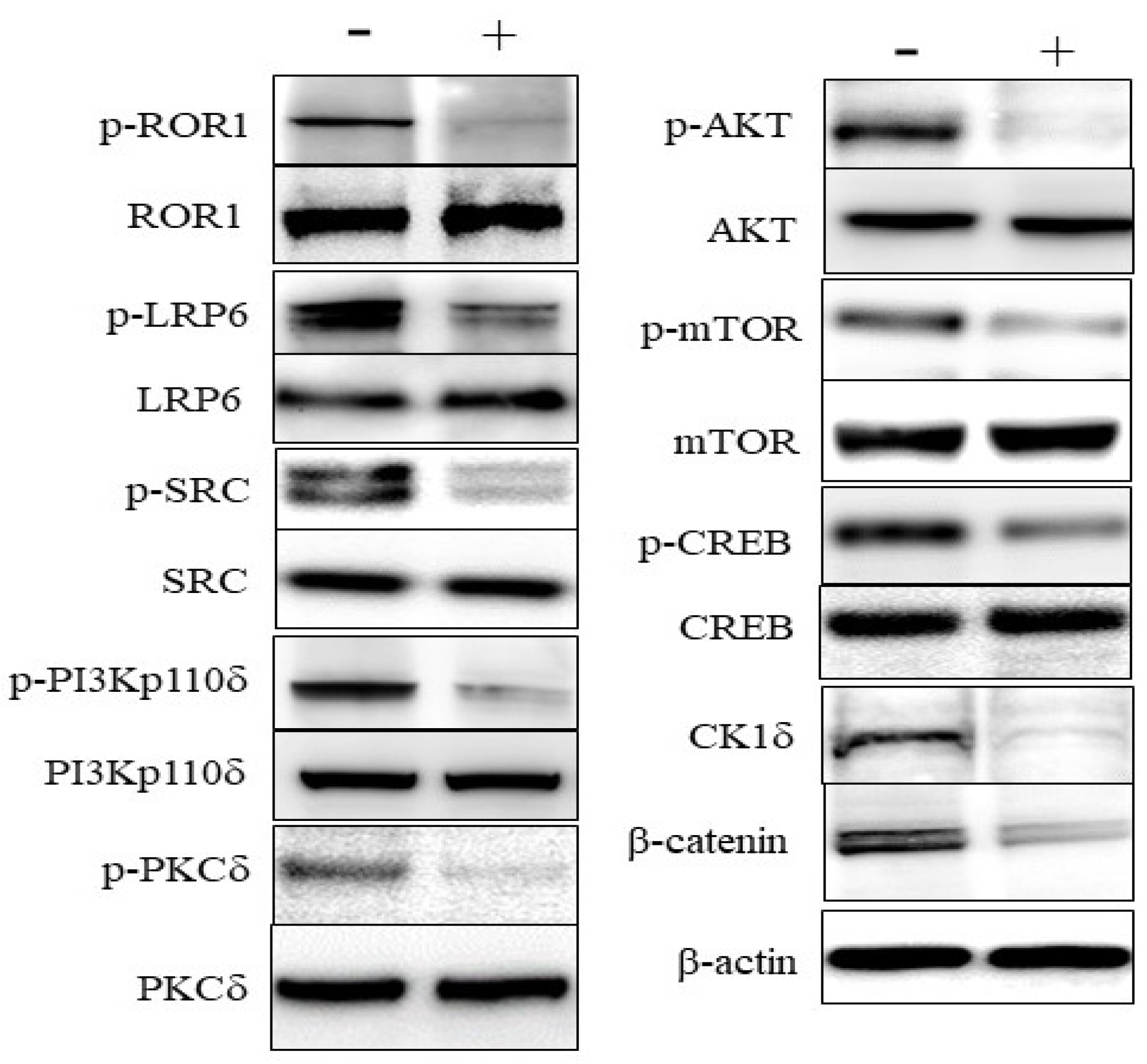 Biomedicines Free Full Text Ror1 Is Expressed In Diffuse Large B Cell Lymphoma Dlbcl And A Small Molecule Inhibitor Of Ror1 Kanc Induced Apoptosis Of Lymphoma Cells Html Biomedicines Free Full Text Ror1 Is Expressed In Diffuse Large B Cell Lymphoma Dlbcl And A Small Molecule Inhibitor Of Ror1 Kanc Induced Apoptosis Of Lymphoma Cells Html