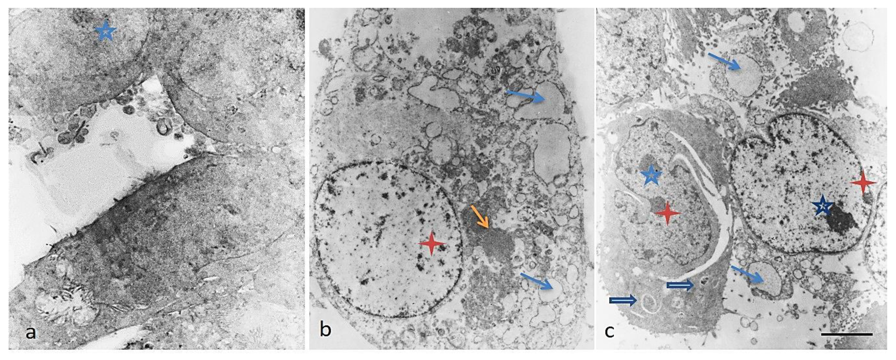 Biomedicines 08 00194 g005 Biomedicines 08 00194 g005