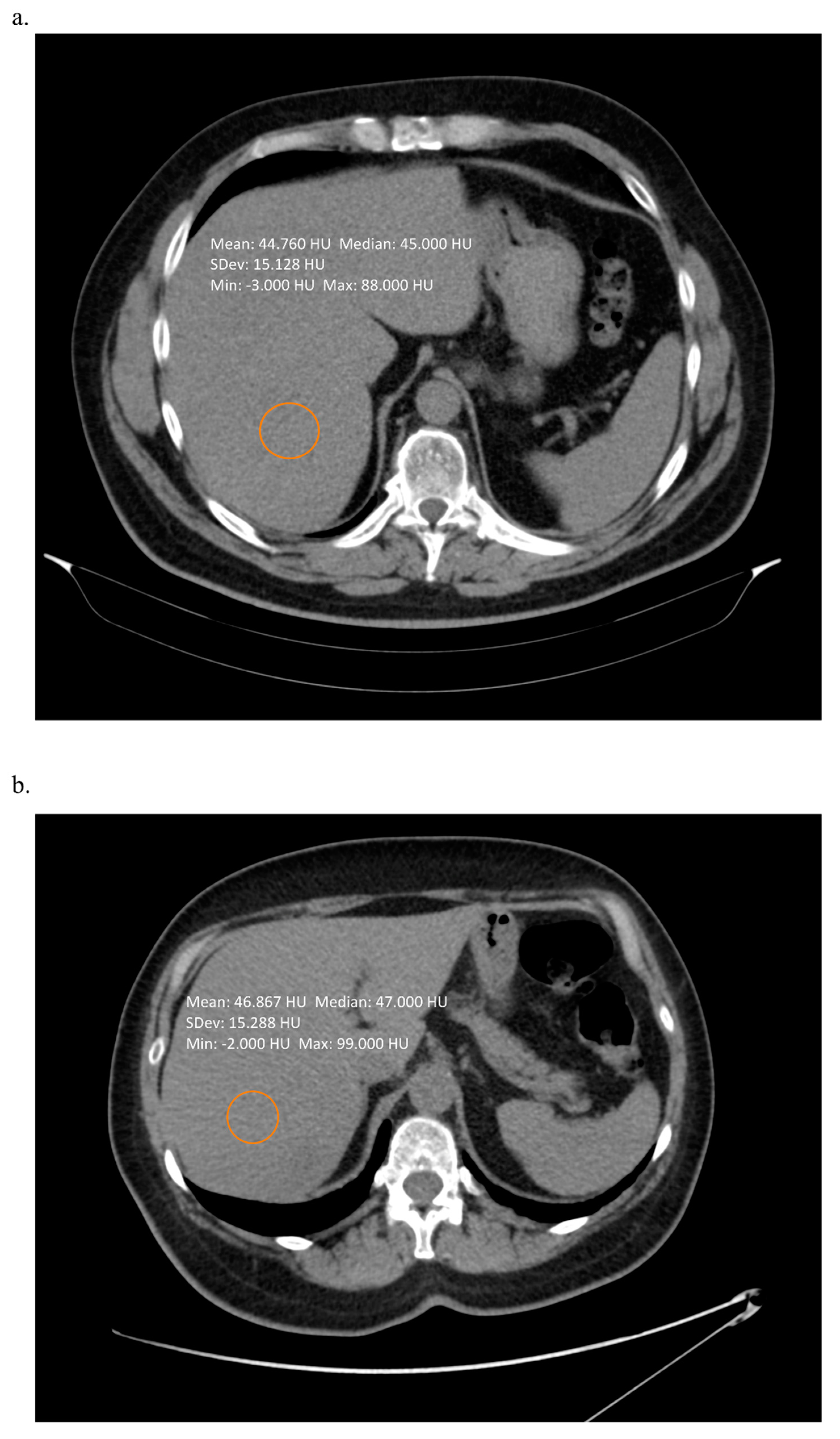 Biomedicines 08 00298 g002 Biomedicines 08 00298 g002