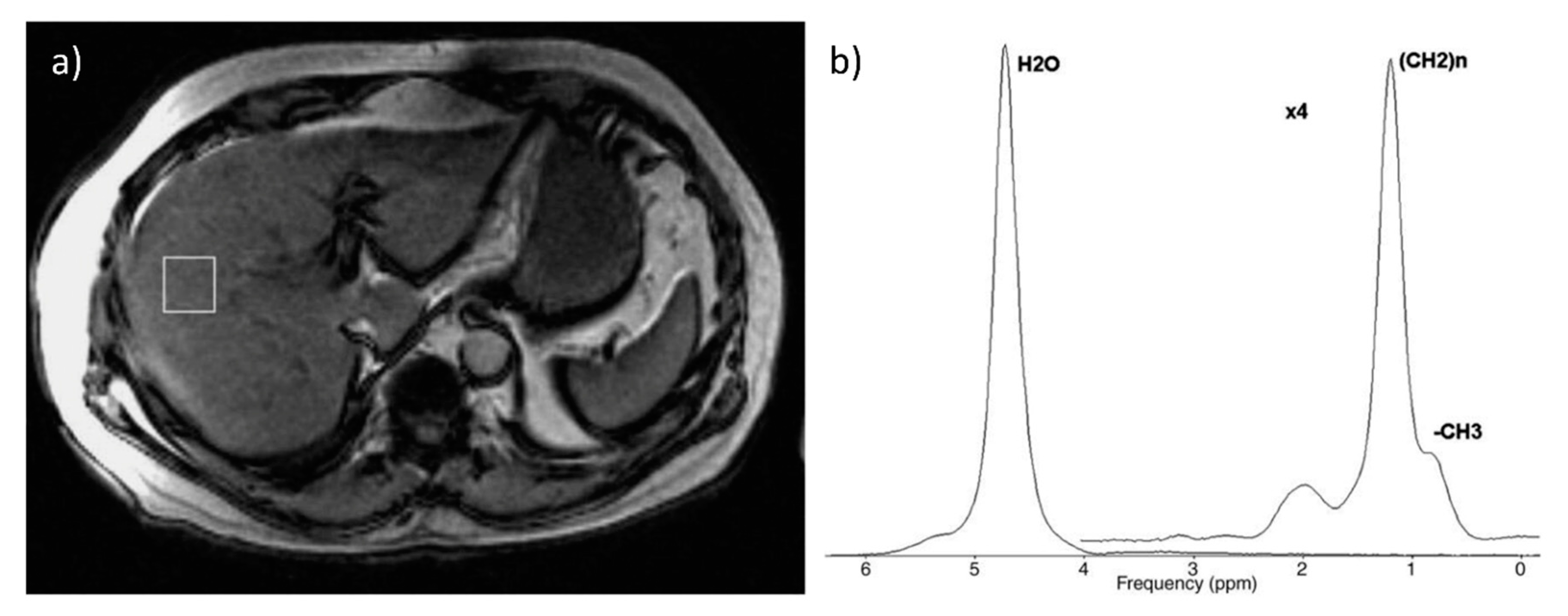 Biomedicines 08 00298 g004 Biomedicines 08 00298 g004