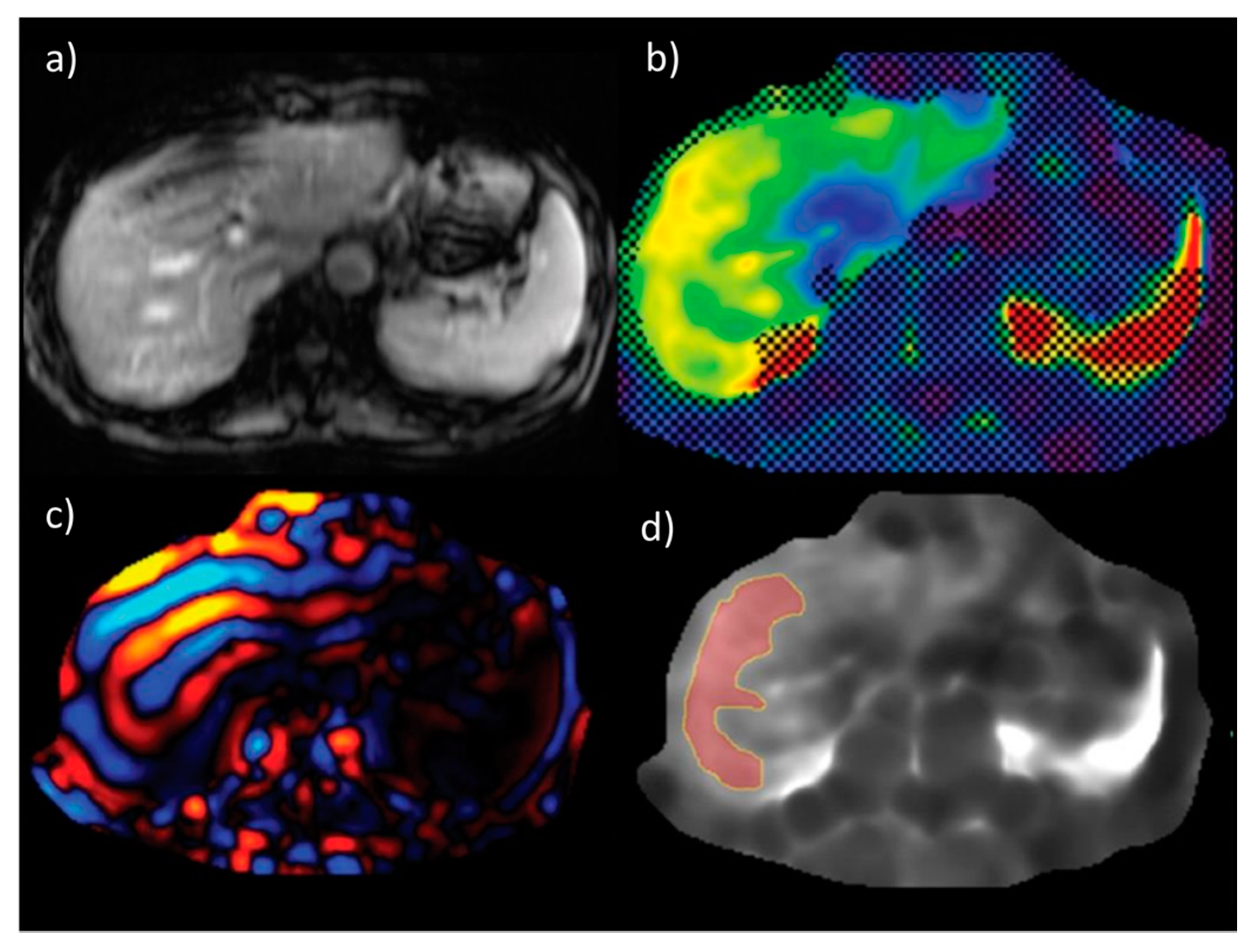 Biomedicines 08 00298 g005 Biomedicines 08 00298 g005