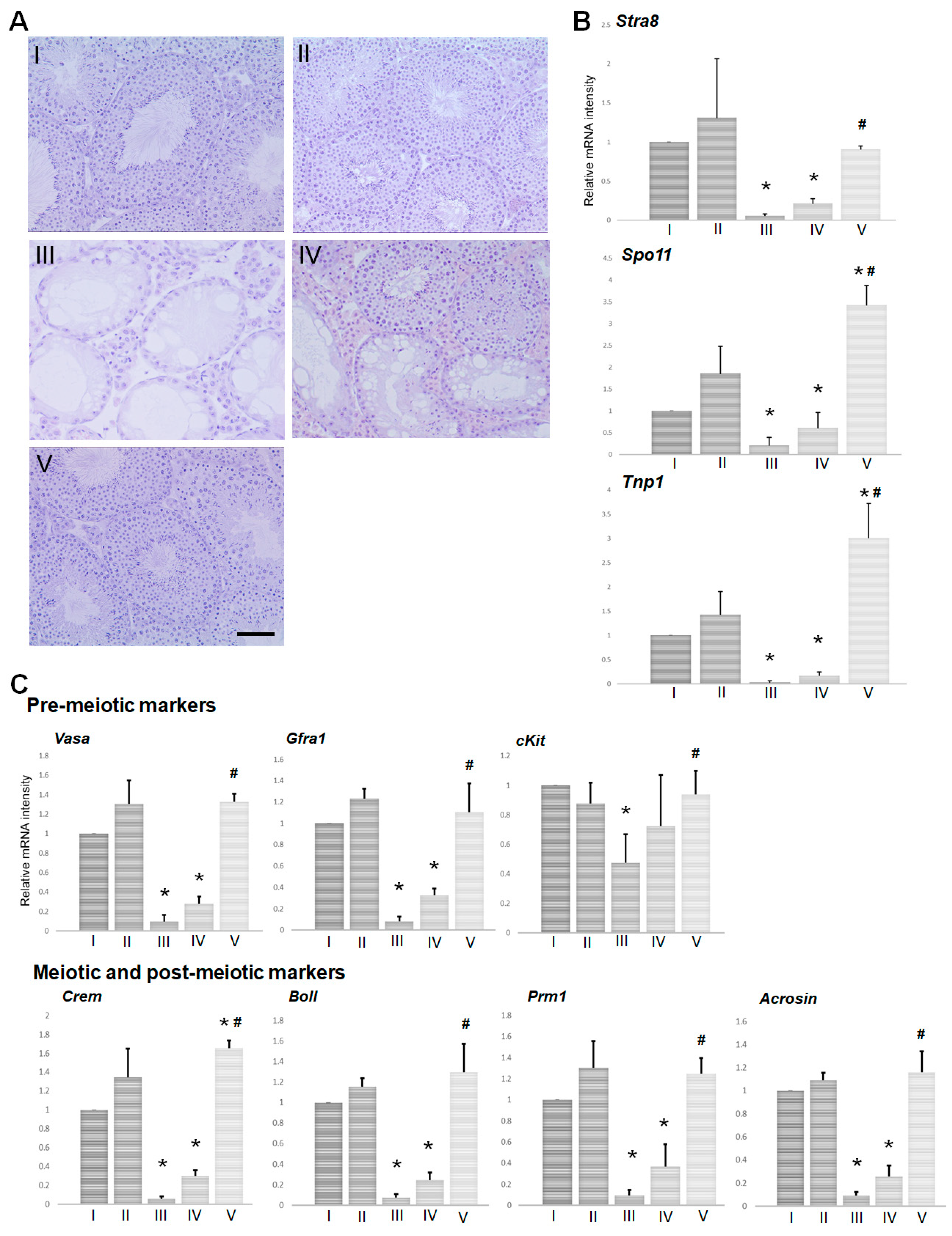 Morphology of Leydig cells in the testes after in vivo MCP-1 treatment.