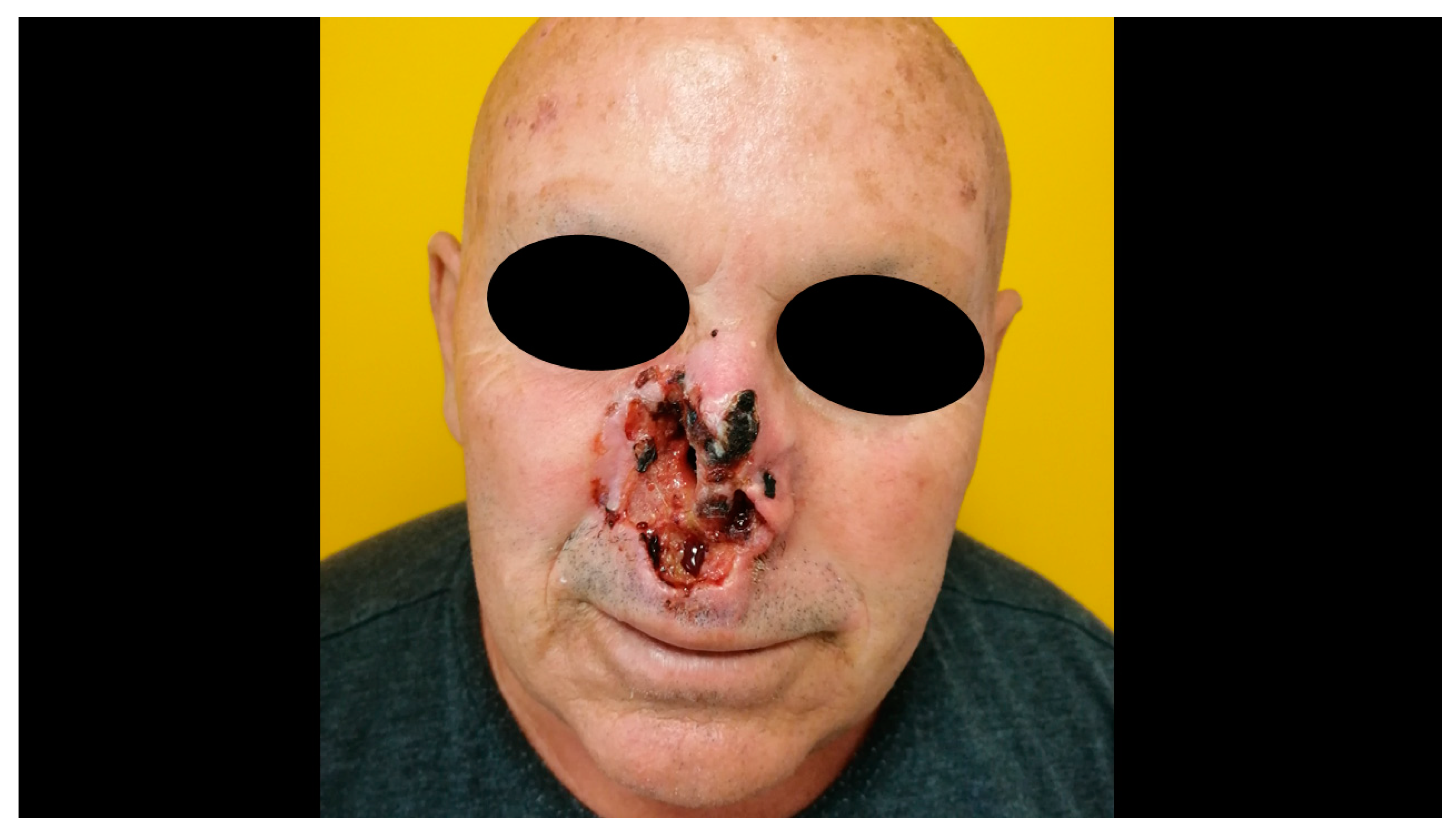 Biomedicines 08 00449 g005