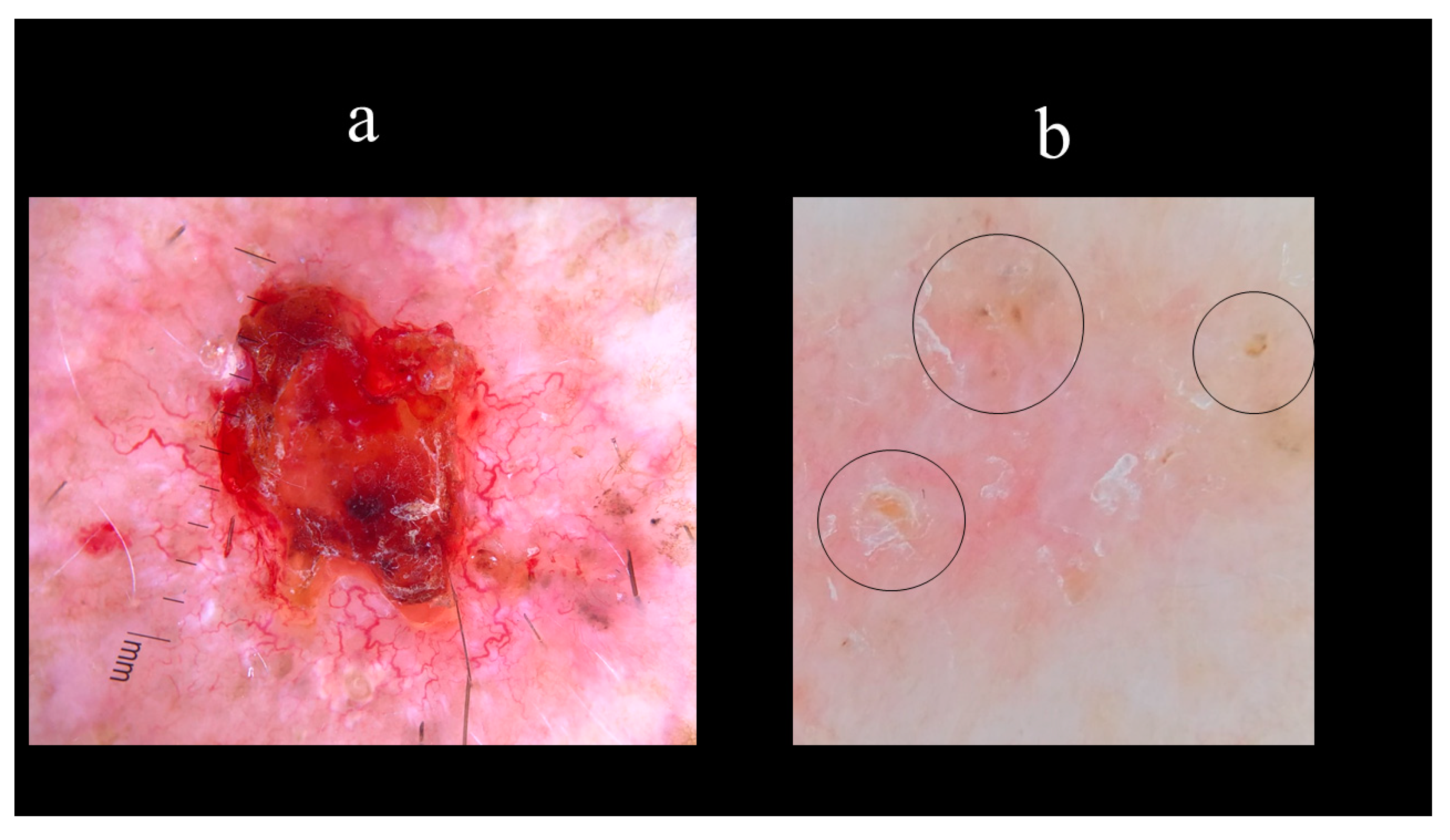 Biomedicines 08 00449 g012