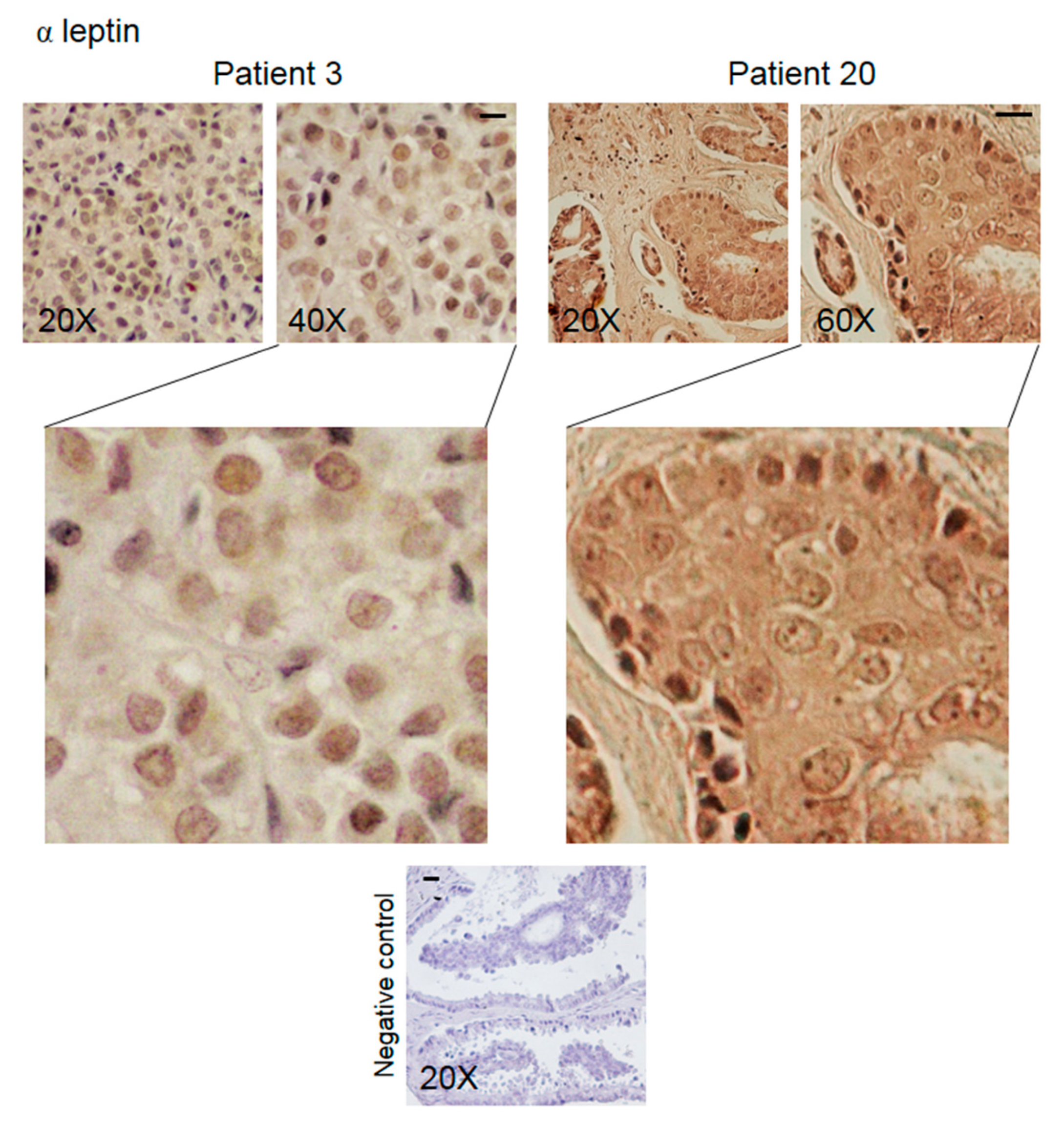 Biomedicines 08 00510 g004