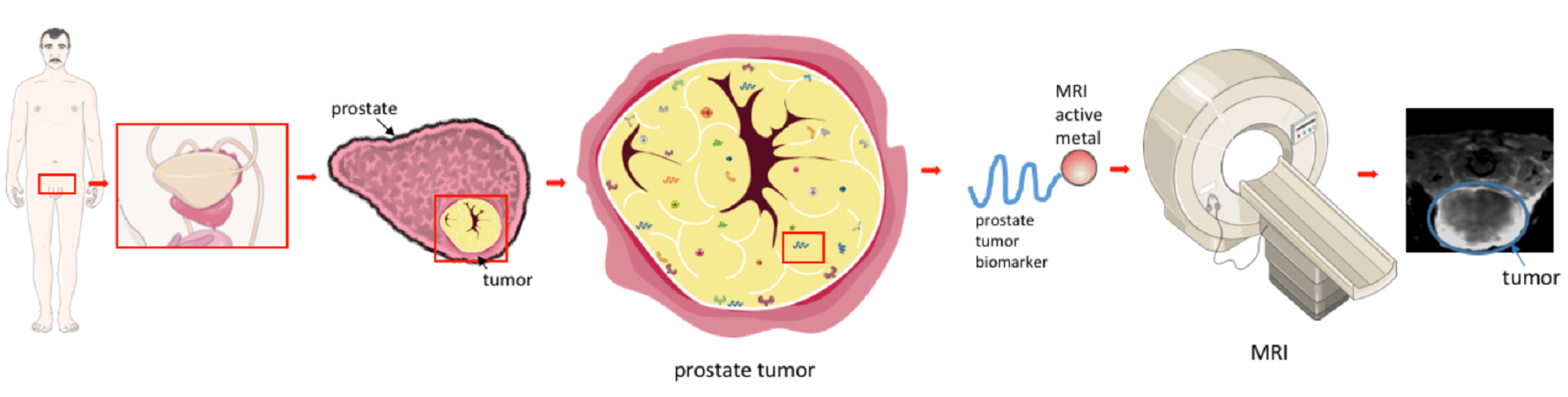 prostate capsule fares prospect ce să faci cu prostatita congestivă