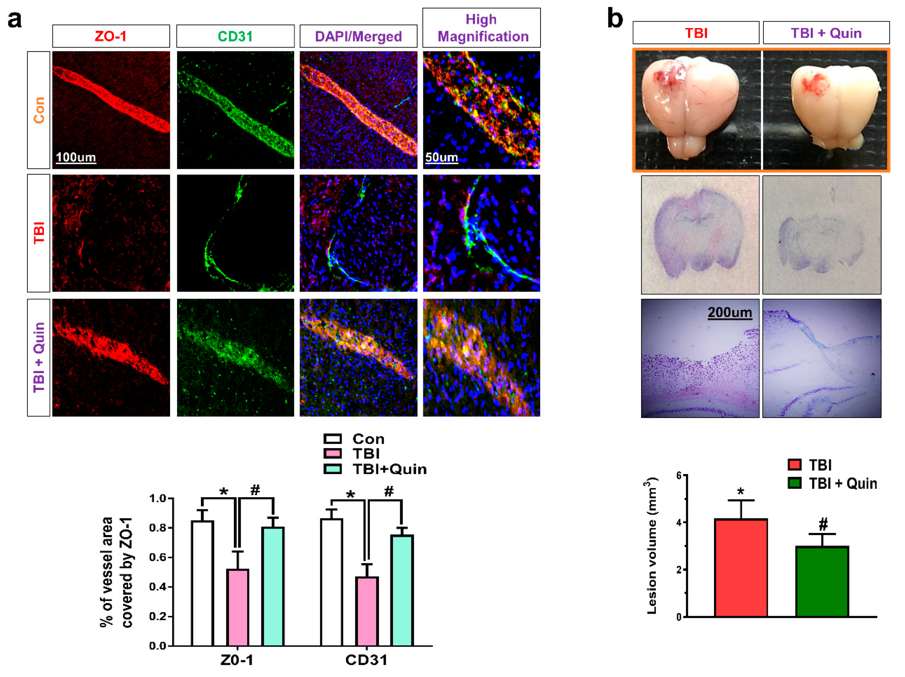 Biomedicines 09 00047 g005