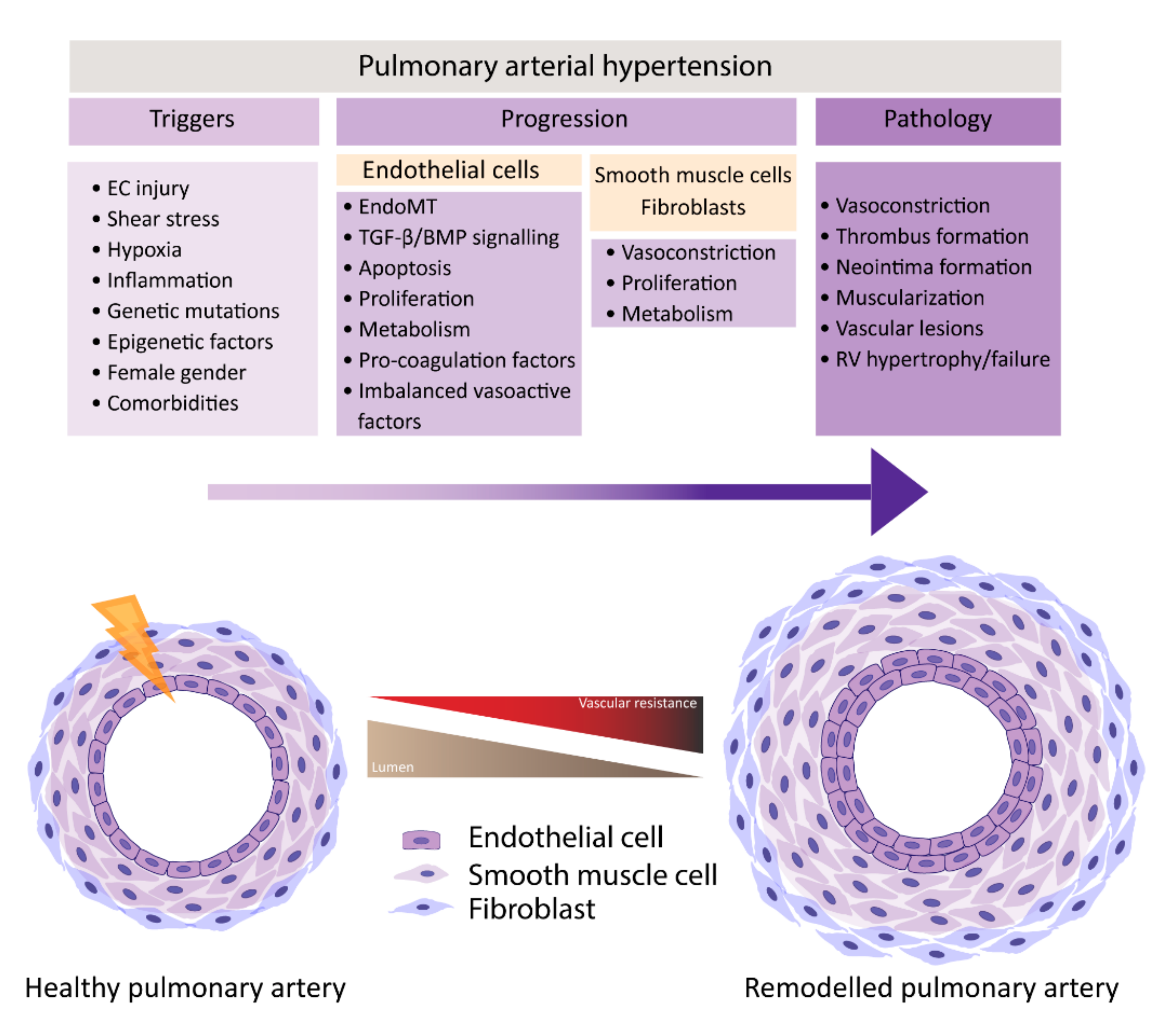 pulmonary artery hypertension