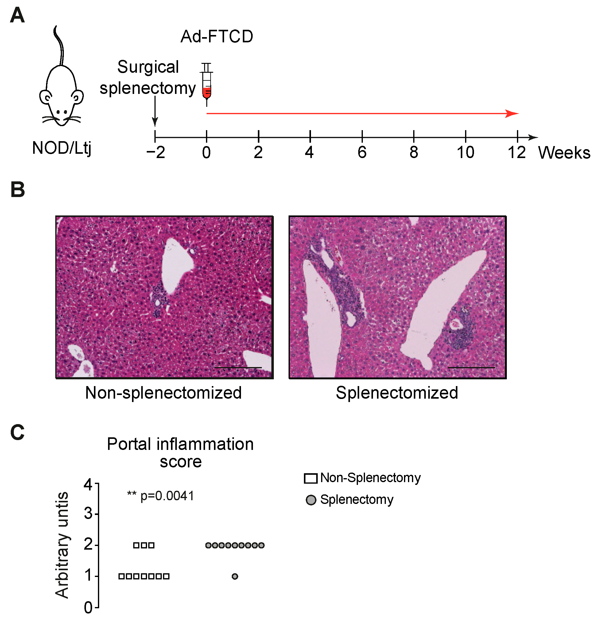 biomedicines free full text splenectomy prior to experimental induction of autoimmune hepatitis promotes more severe hepatic inflammation production of il 17 and apoptosis html