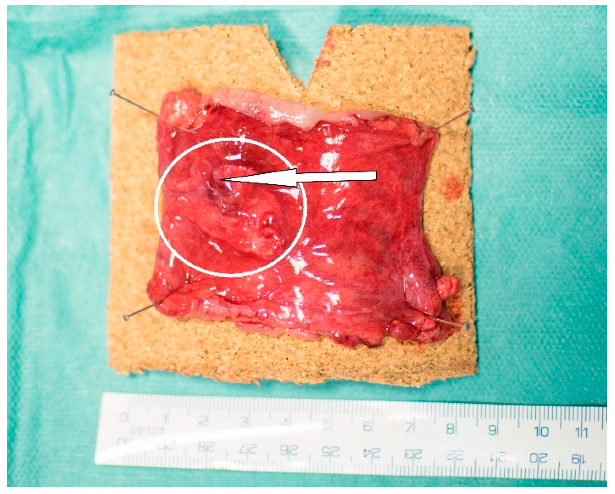 Biomedicines 09 00102 g005